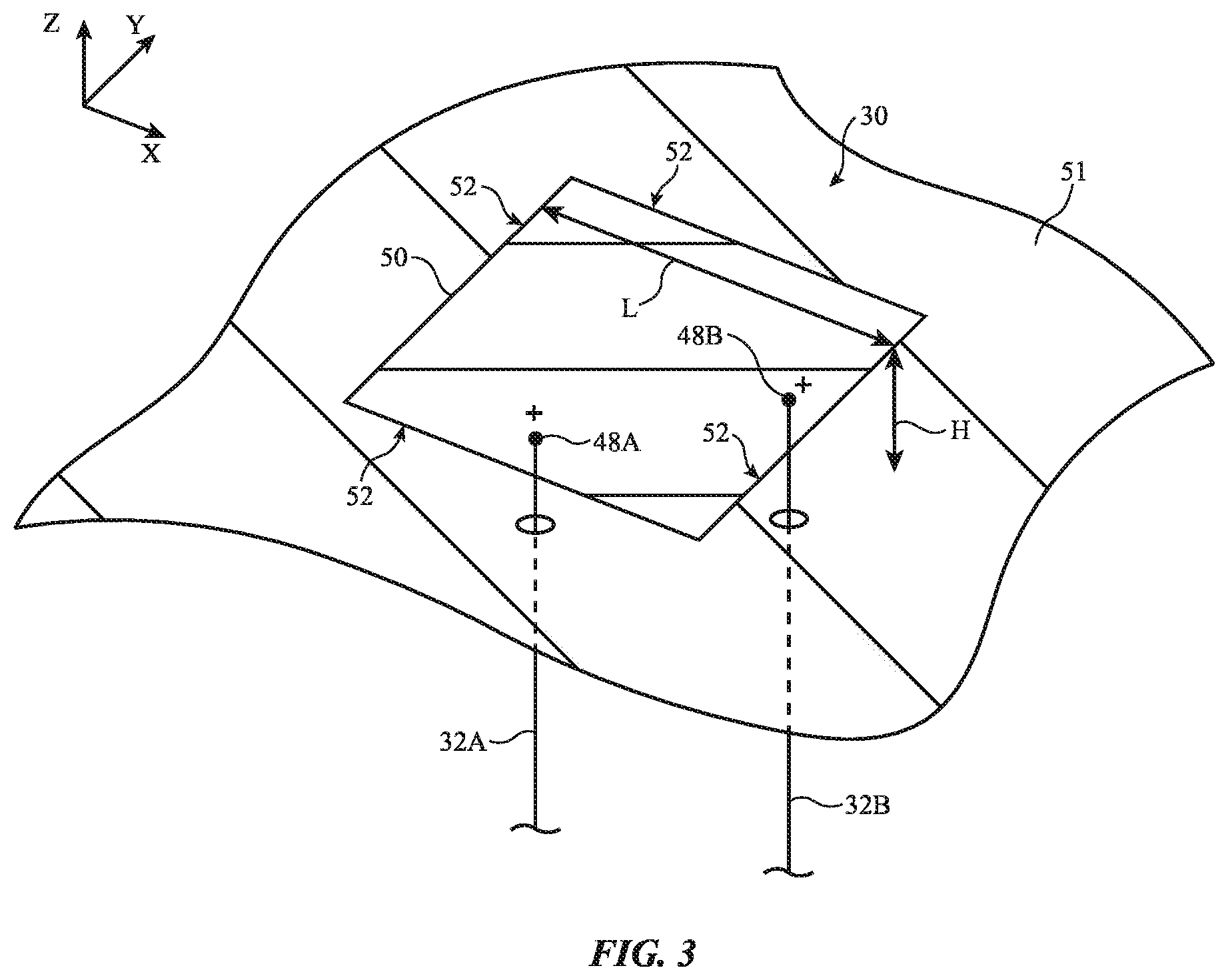Patent US12614852 Figure 3 – Communication terminal with interwoven and free-standing antenna radiators