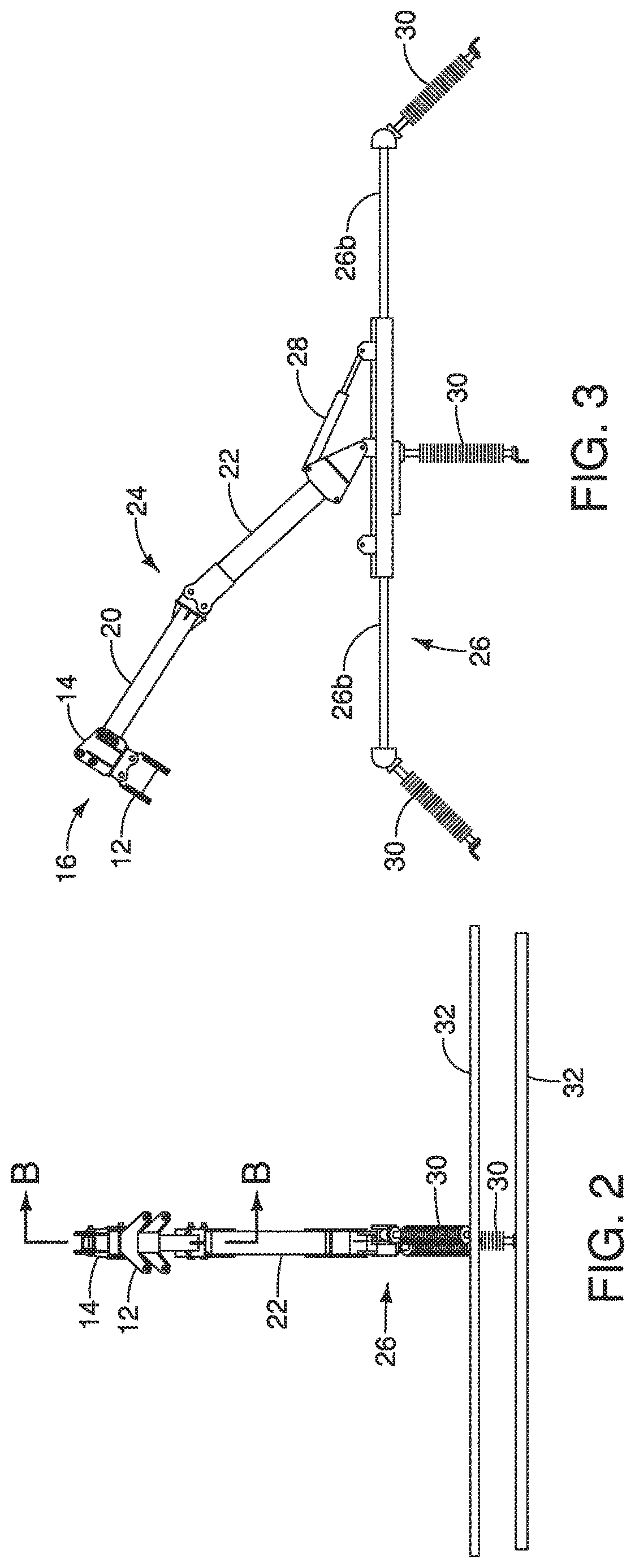 Patent US12614896 Figure 2 – Mounting a robotic arm in an inverted position to suspend an electrical bypass