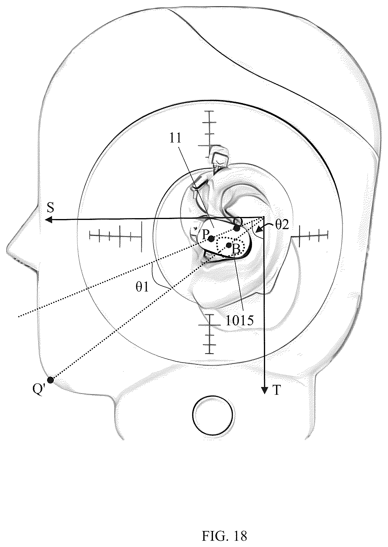 Patent US12615465 Figure 15 – Earphones