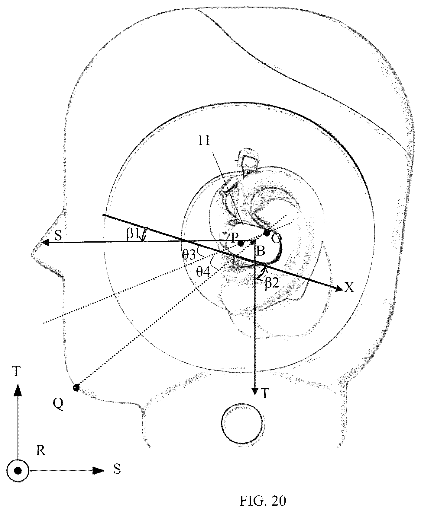 Patent US12615465 Figure 17 – Earphones
