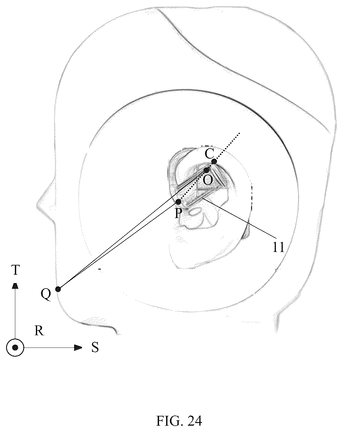 Patent US12615465 Figure 20 – Earphones