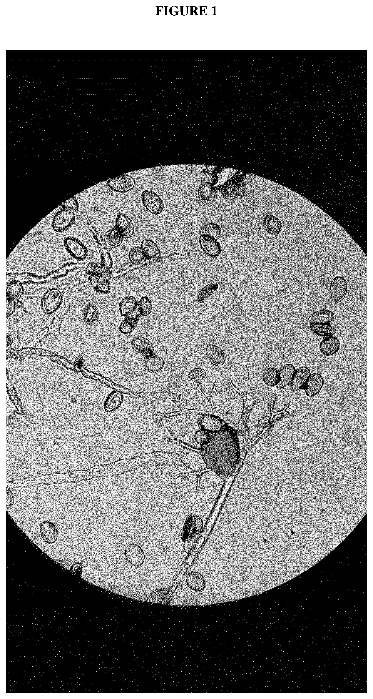 Patent US12616109 — Spinach plants resistant to Peronospora farinosa and Stemphylium vesicarium — Figure 1