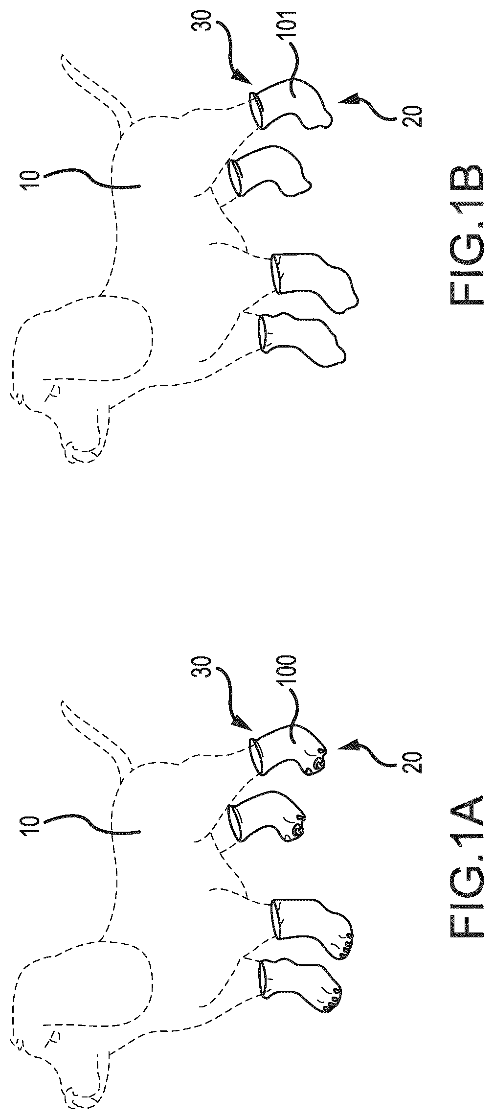 Patent US12616172 Figure 1 – Second skin paw protectors