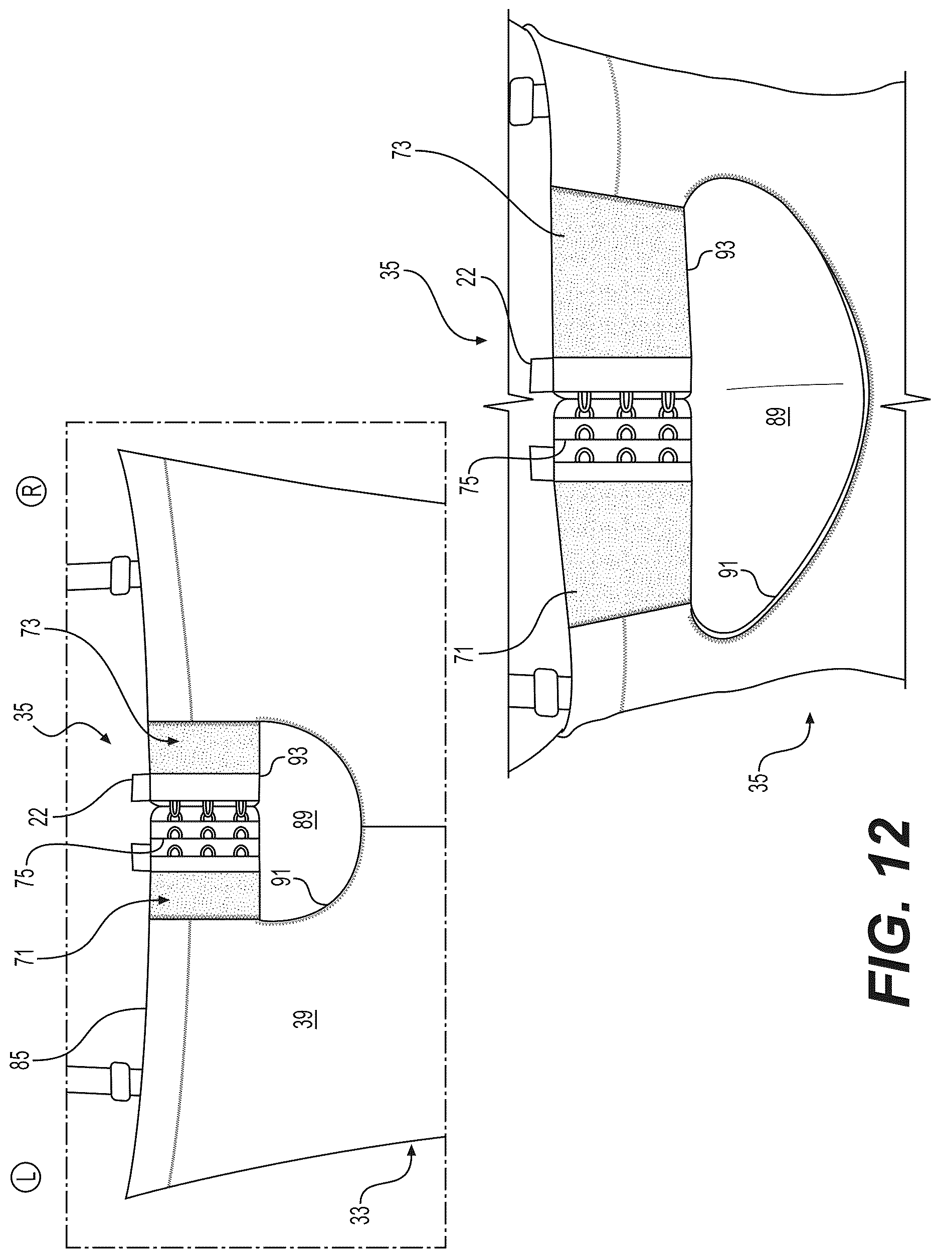 Patent US12616253 Figure 10 – Shaping garment with fit-adjustable brassiere portion
