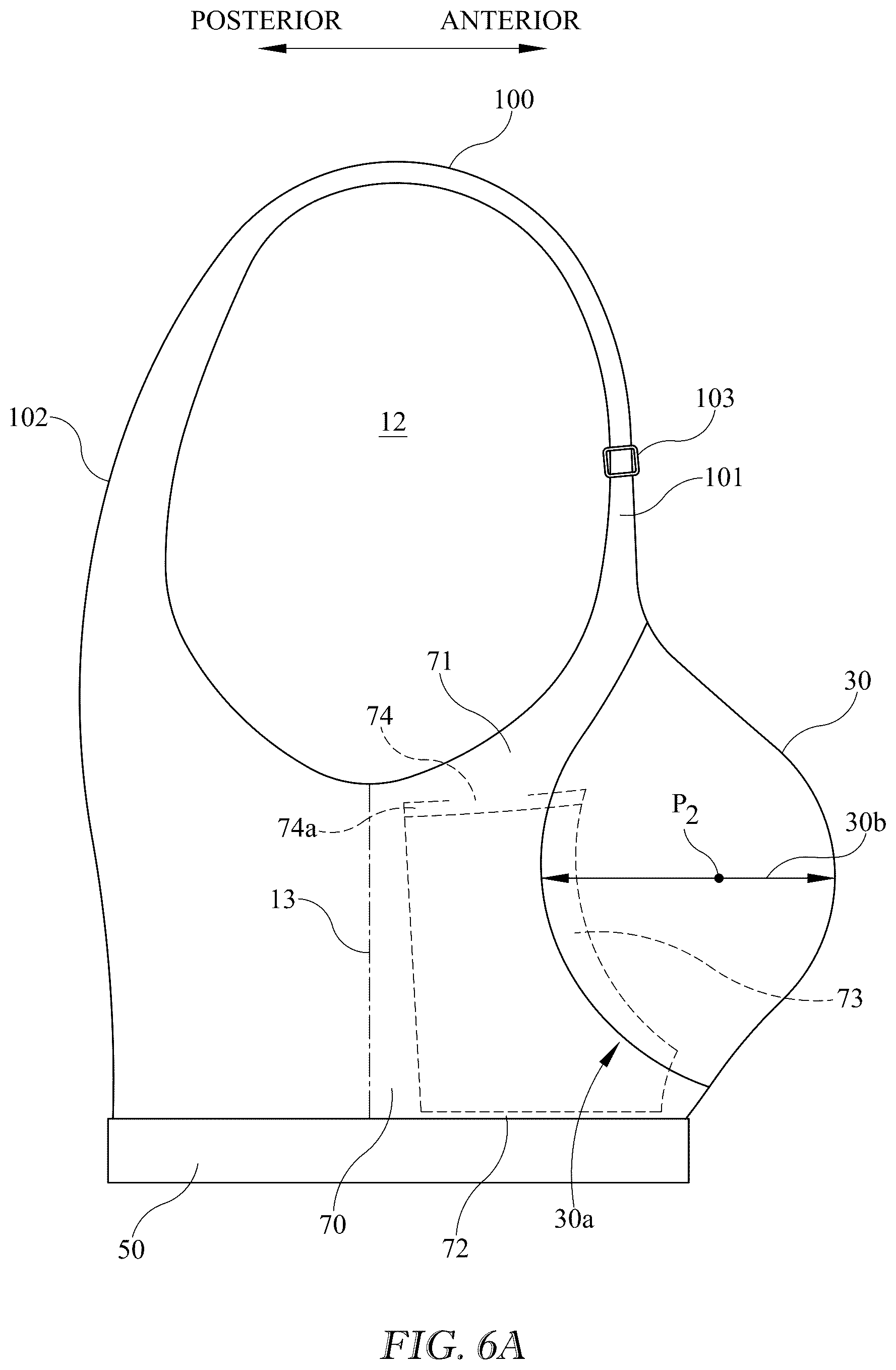 Patent US12616255 Figure 7 – Breast support garment