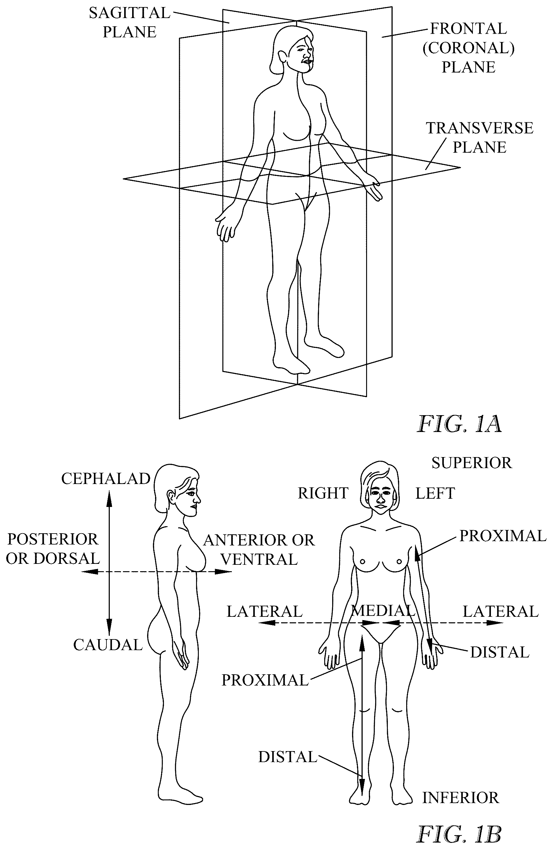 Patent US12616257 Figure 1 – Breast support garment