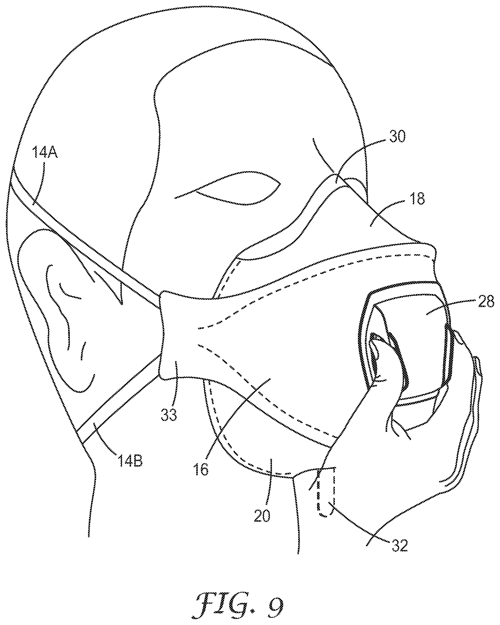 Patent US12616258 Figure 6 – Respirator tab