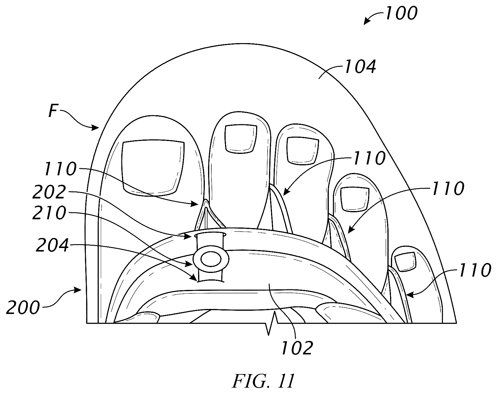 Patent US12616273 Figure 18 – Shoe with improved stability