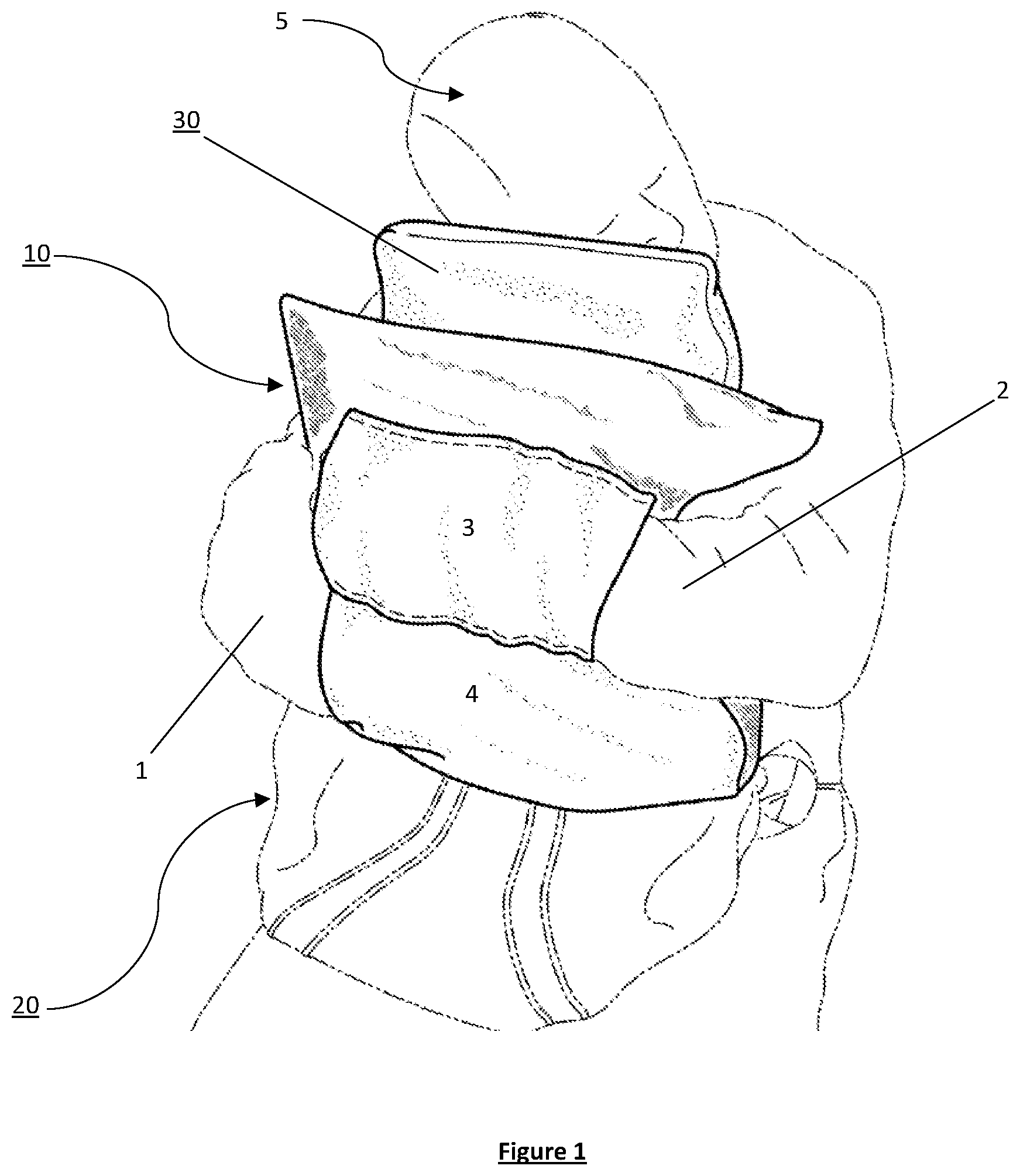 Patent US12616309 Figure 1 – Apparatus for use with portable head support