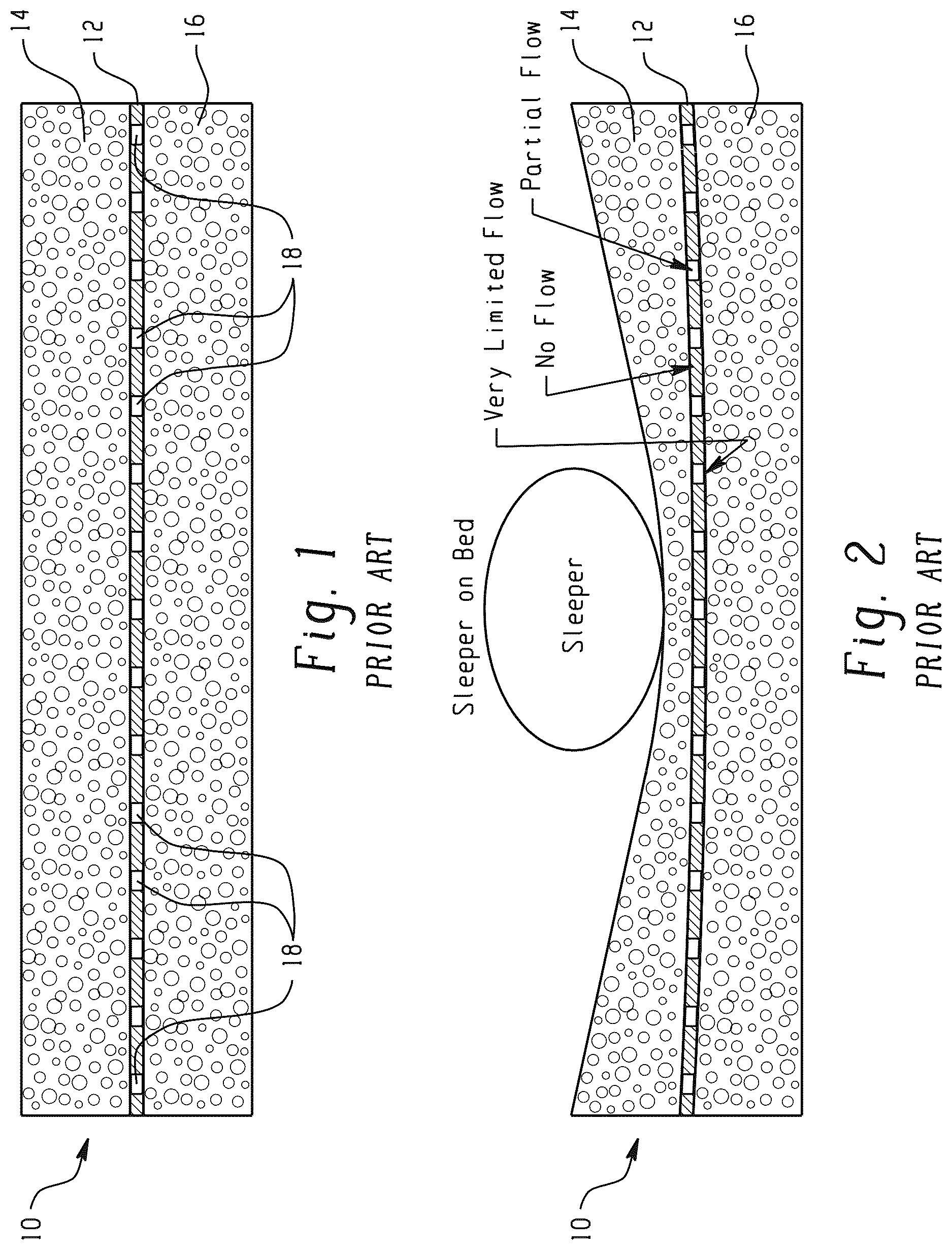 Patent US12616310 Figure 1 – Mattress assembly with reduced heat index