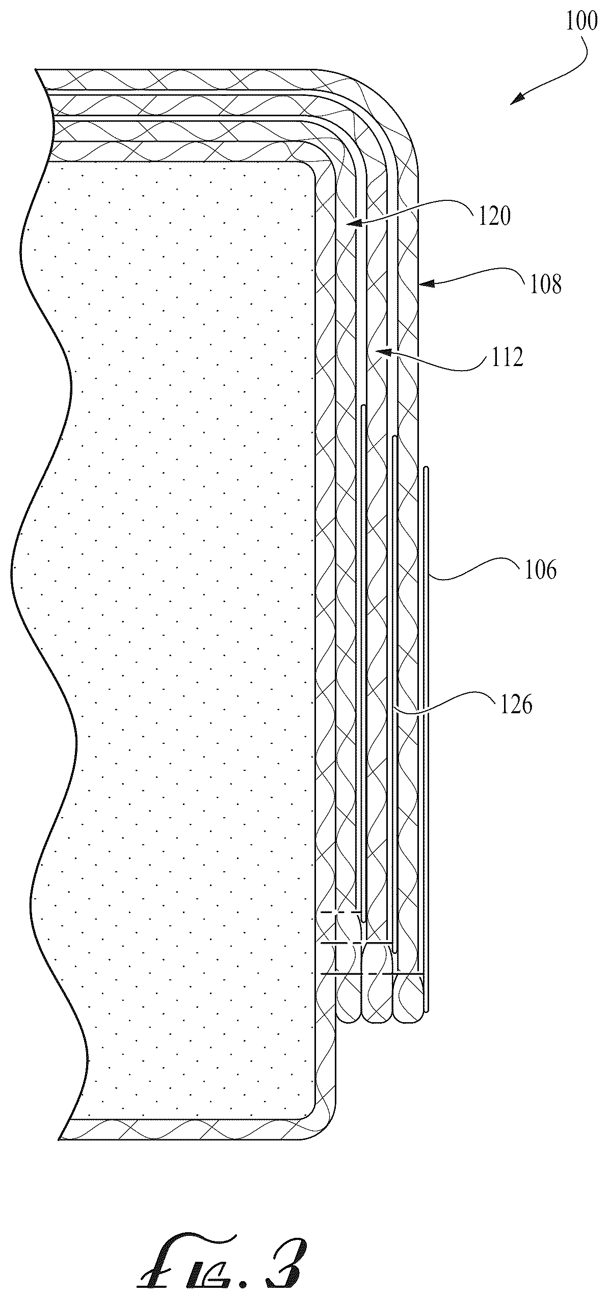 Patent US12616321 Figure 3 – Mattress cover with removable fabric layers