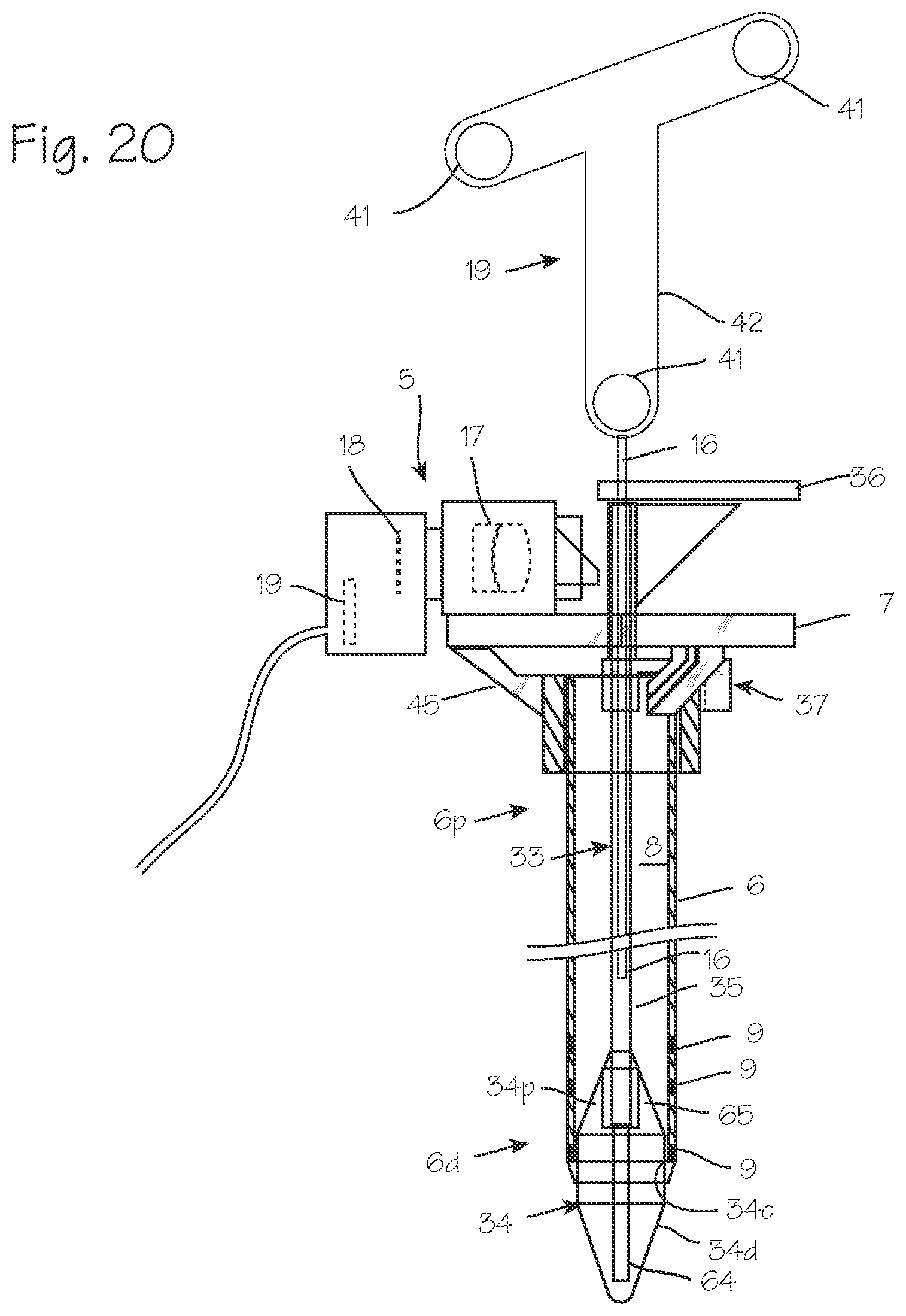 Patent US12616359 Figure 10 – Cannula and obturator with a transparent tip with an opaque component