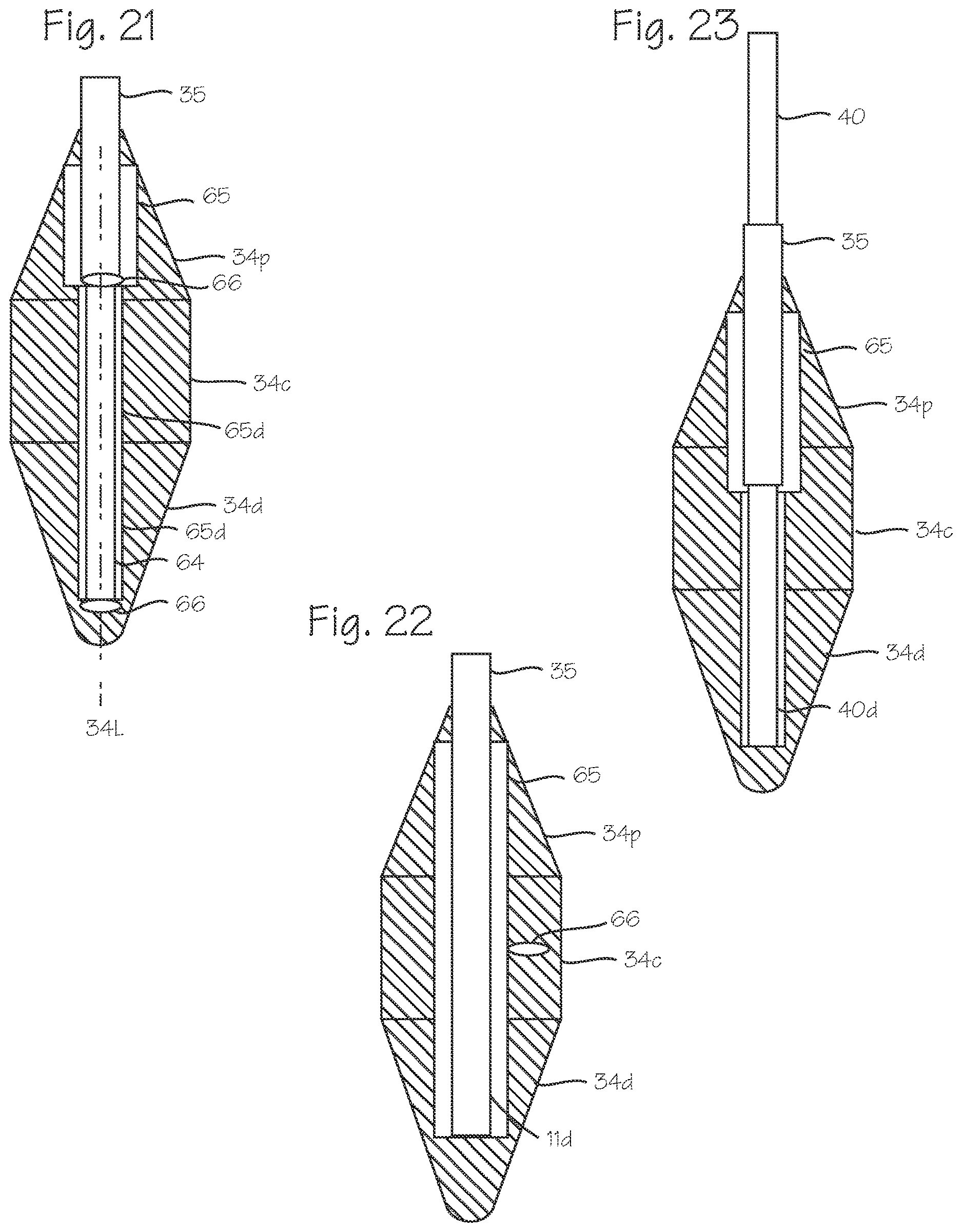 Patent US12616359 Figure 11 – Cannula and obturator with a transparent tip with an opaque component