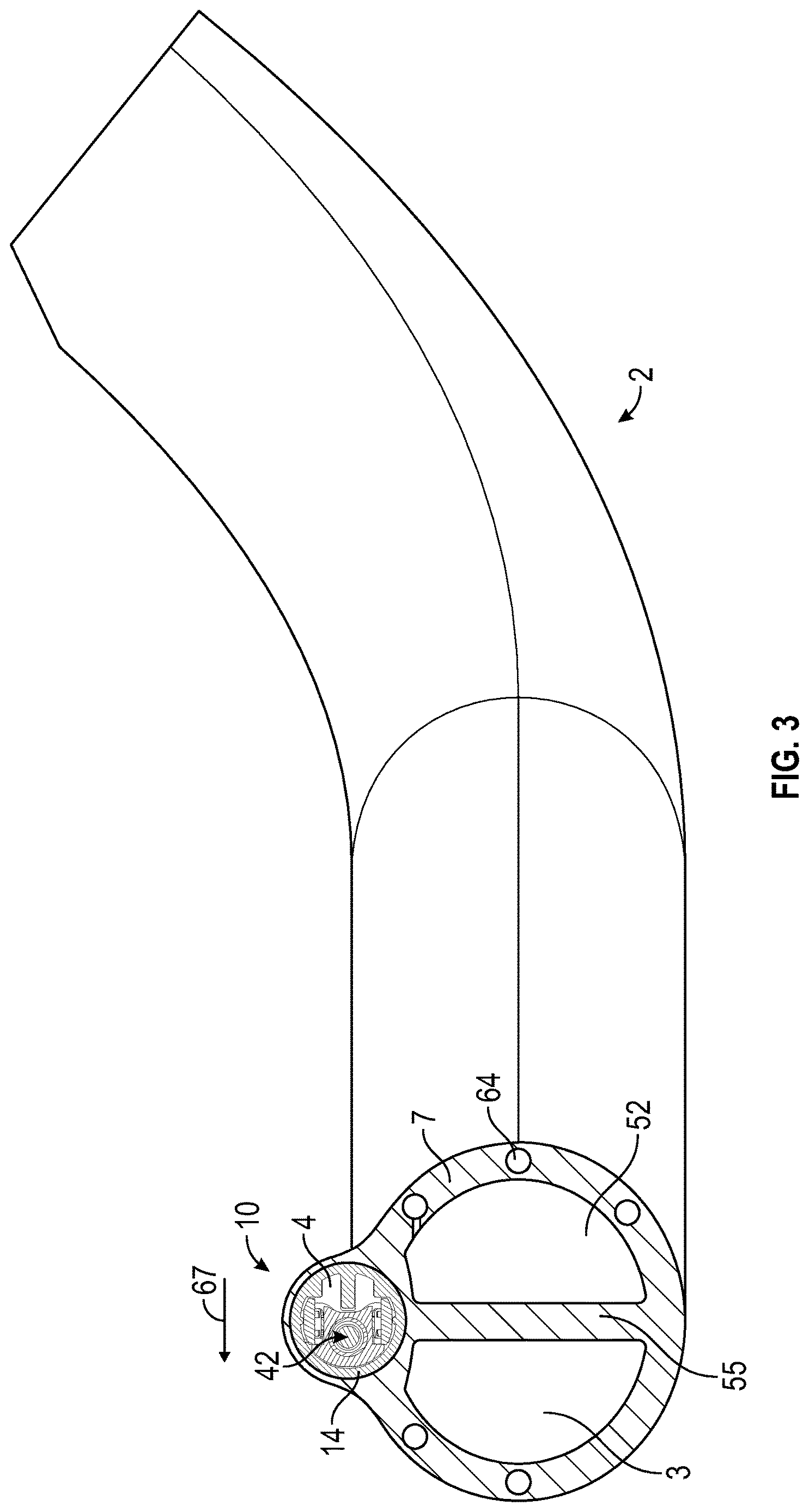 Patent US12616361 Figure 3 – Medical device including a tube