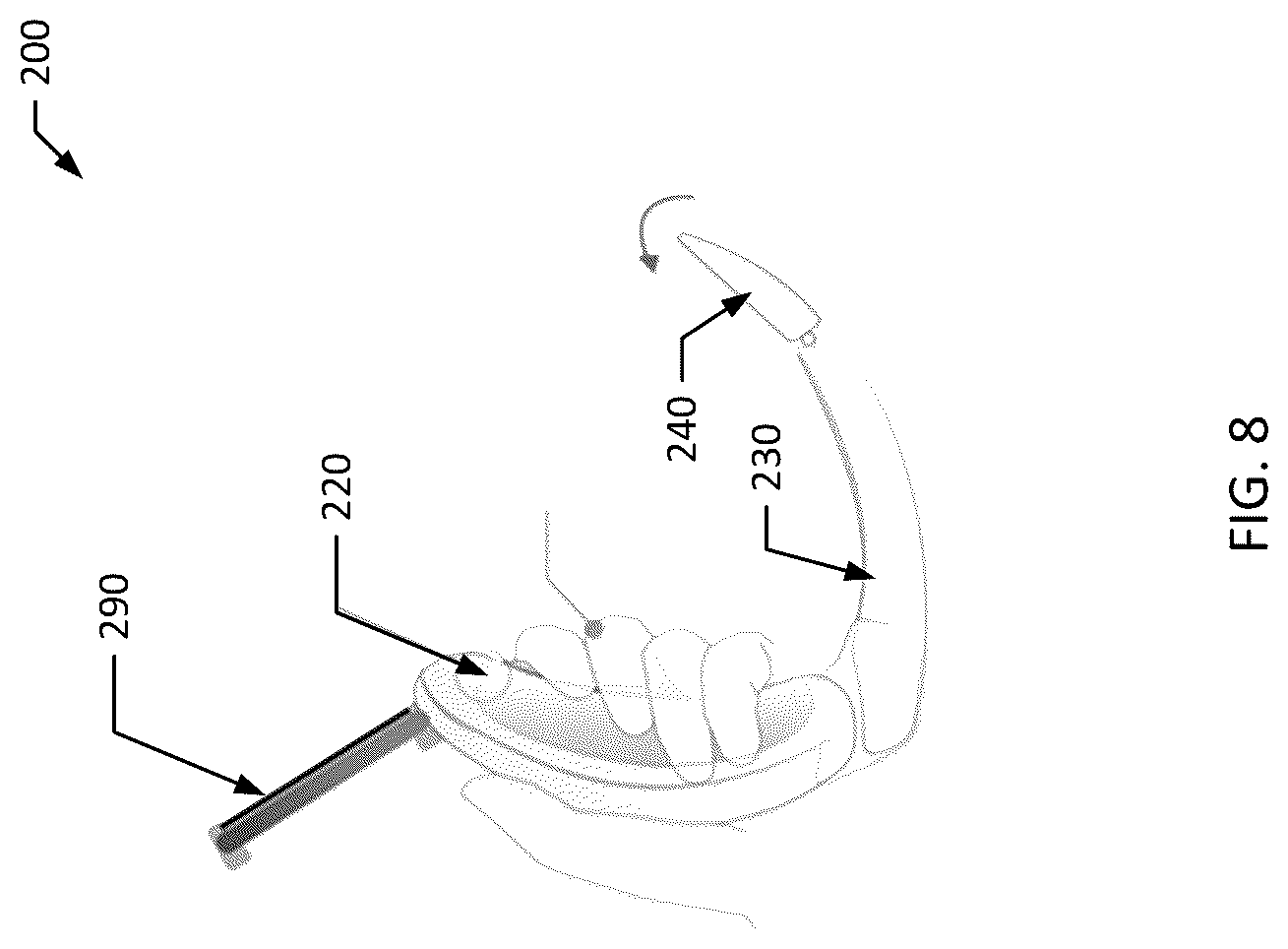 Patent US12616364 Figure 8 – Videolaryngoscopy device for endotracheal intubation