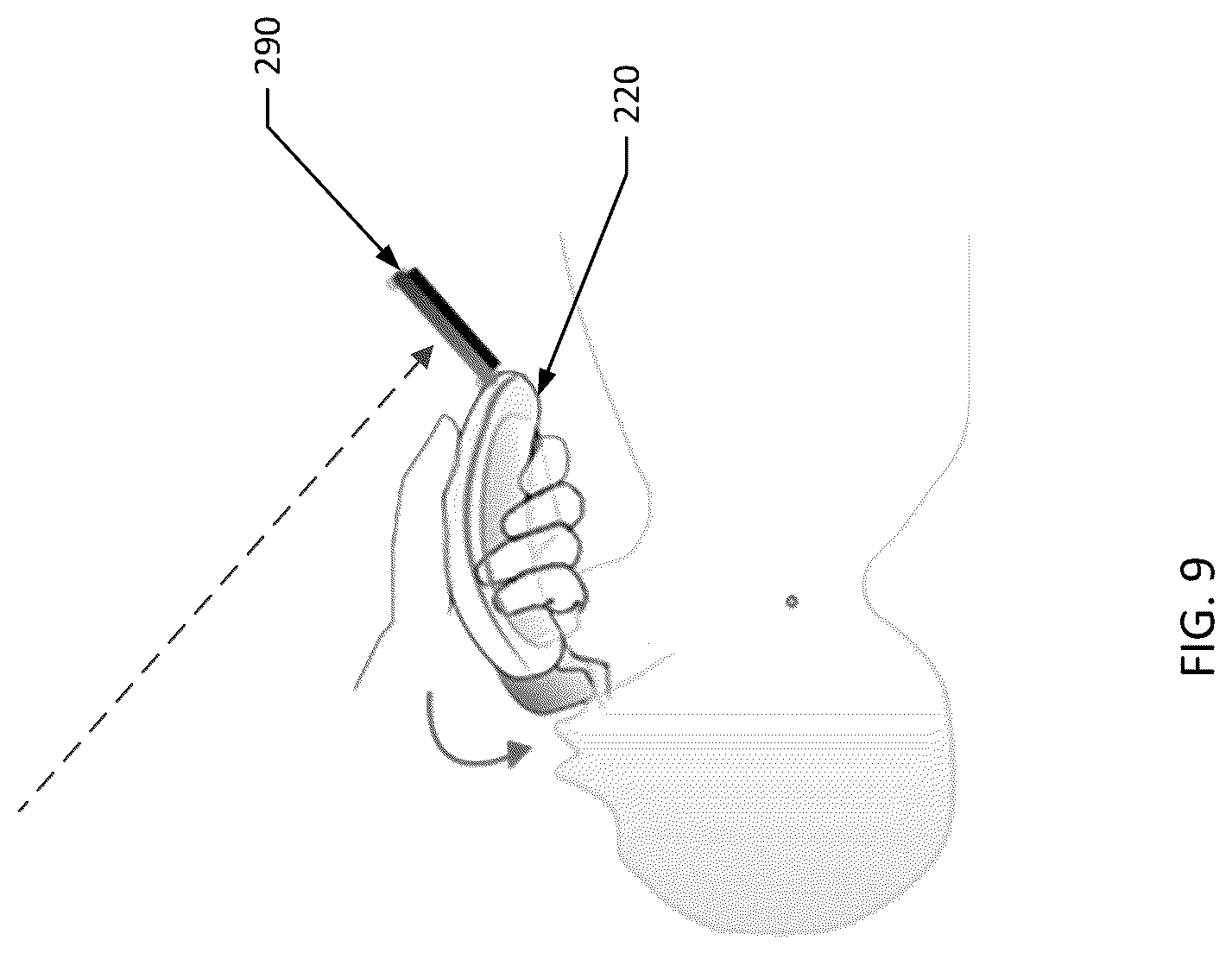 Patent US12616364 Figure 9 – Videolaryngoscopy device for endotracheal intubation