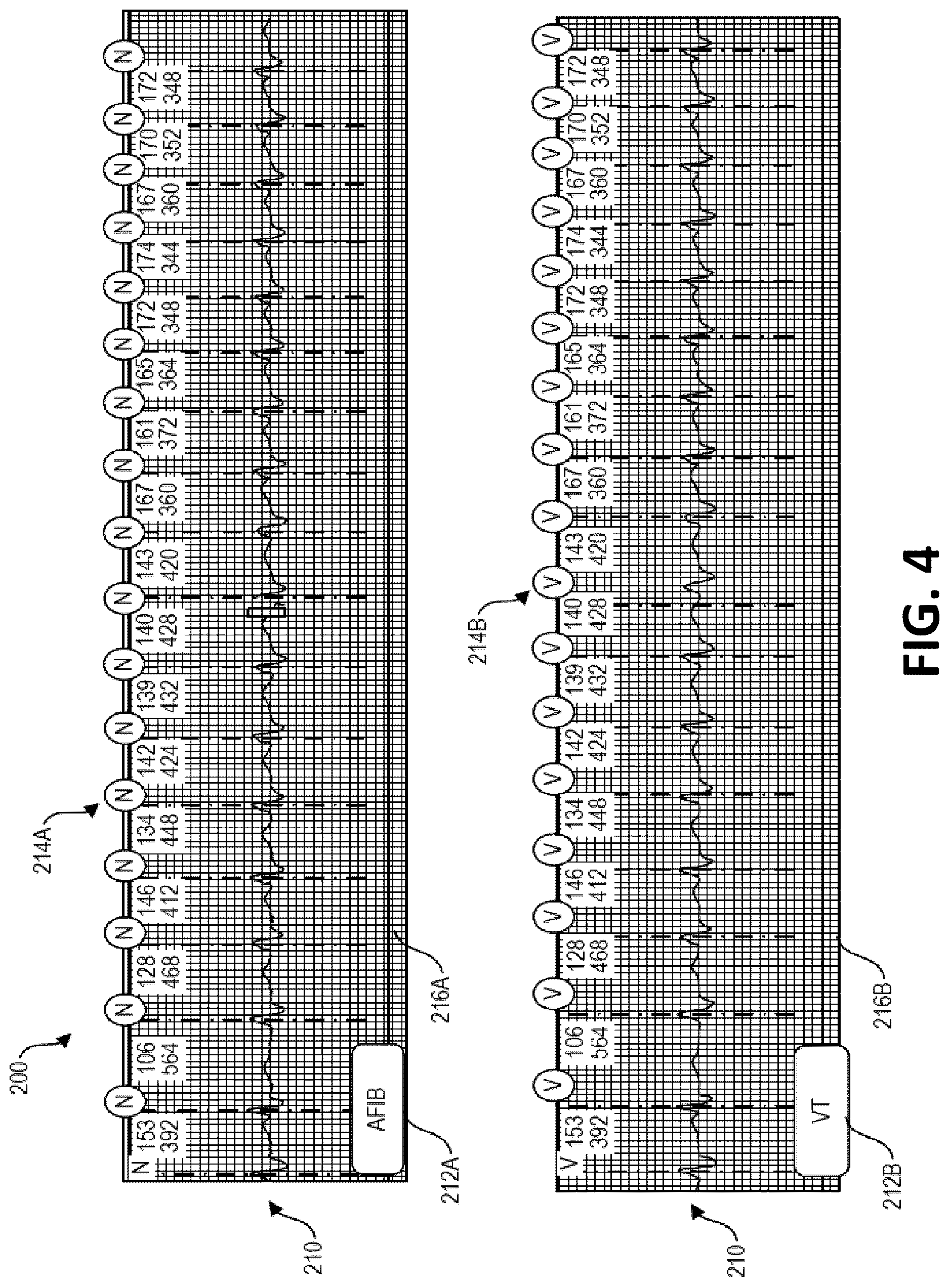 Patent US12616368 Figure 4 – Beat reclassification