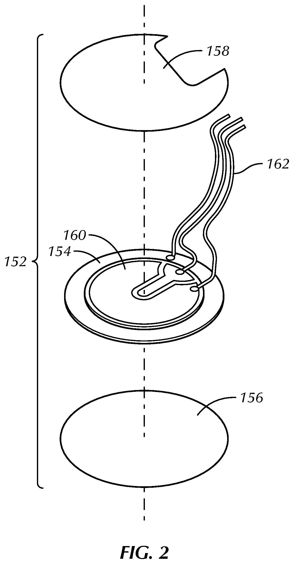 Patent US12616369 Figure 2 – Component mounting system and method for an implantable medical device
