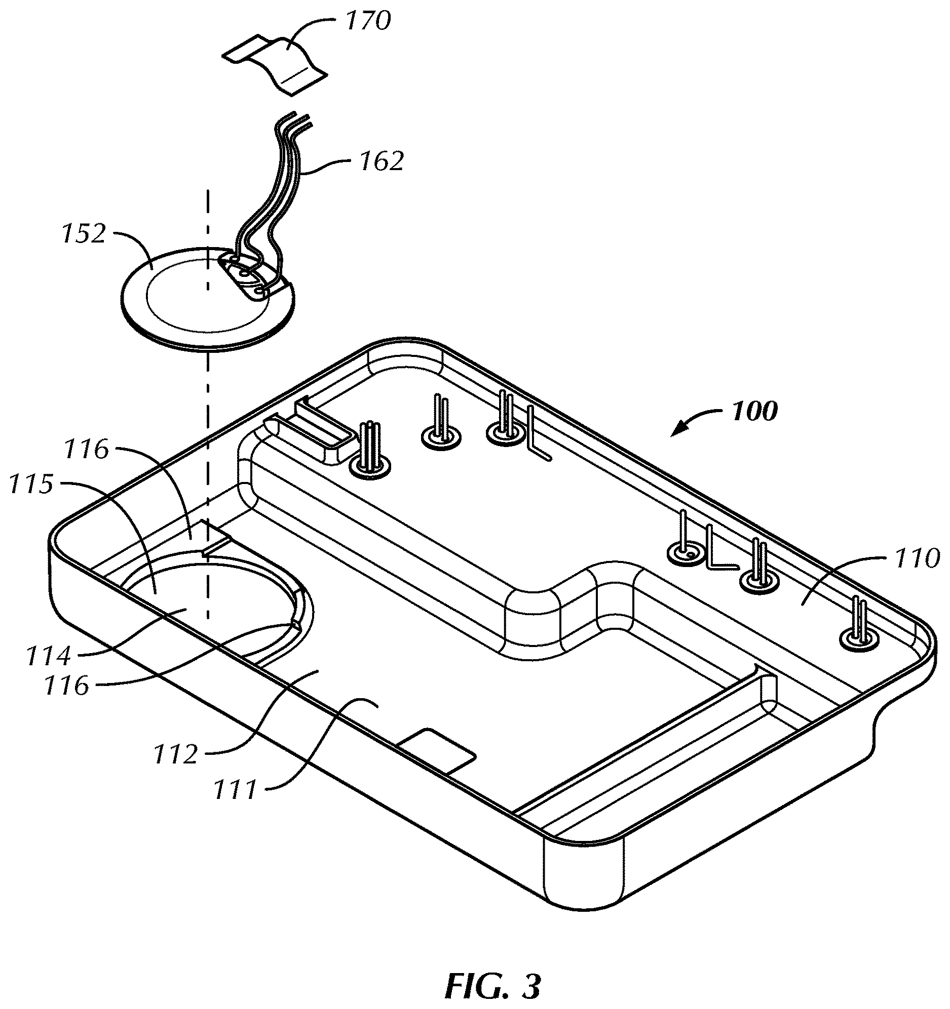 Patent US12616369 Figure 3 – Component mounting system and method for an implantable medical device