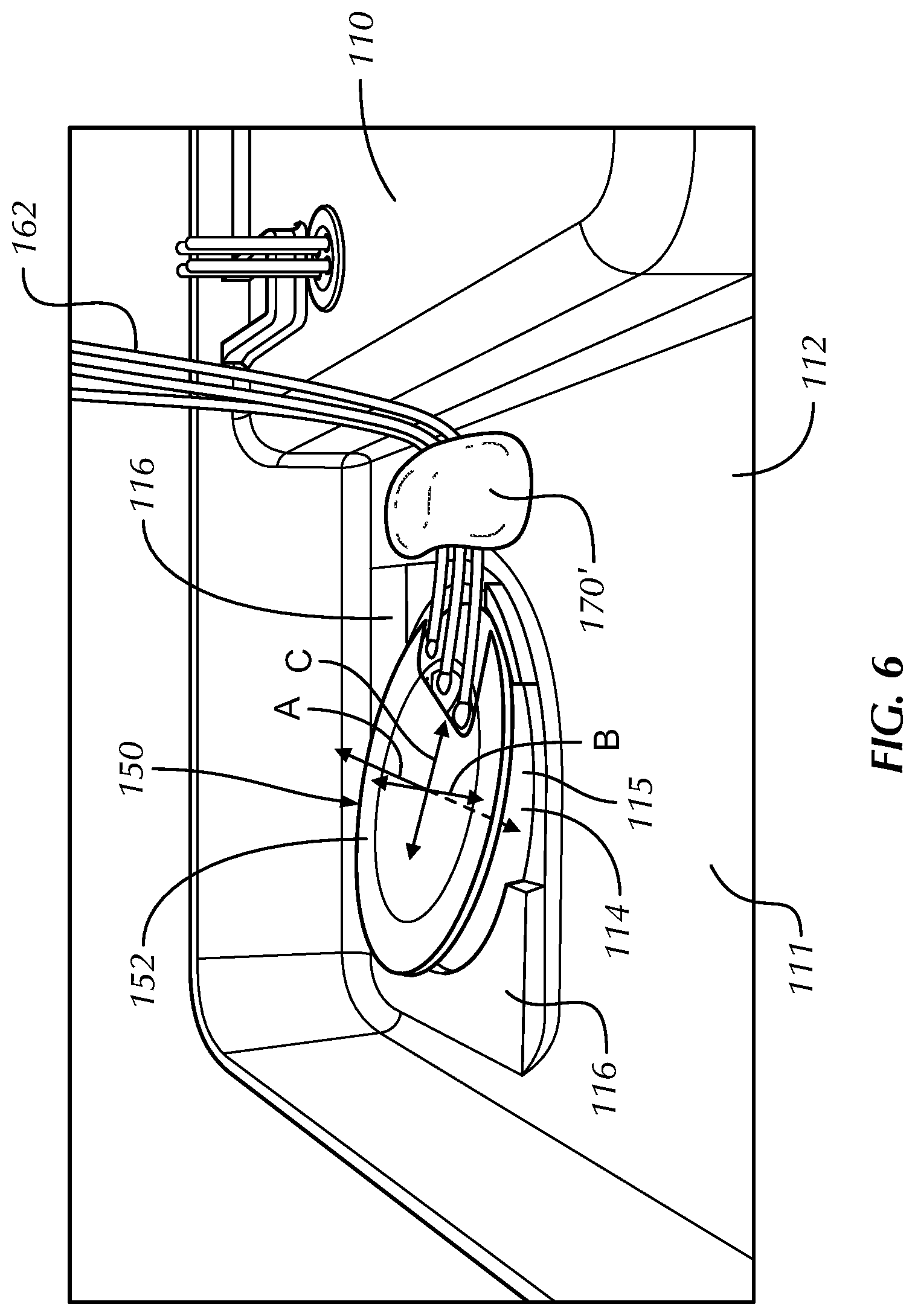 Patent US12616369 Figure 6 – Component mounting system and method for an implantable medical device