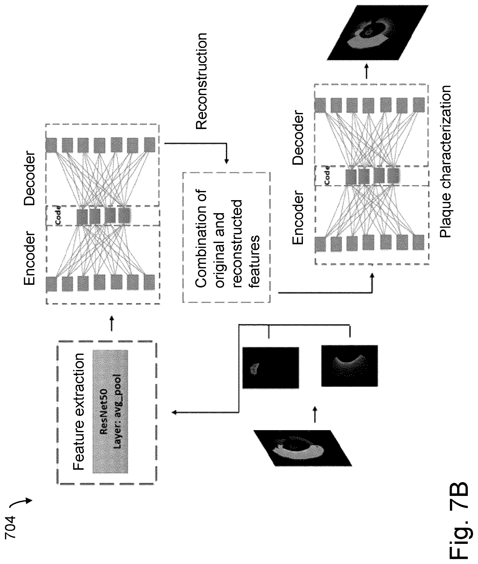 Patent US12616370 Figure 7 – System and method for determining atherosclerotic pathological tissue types in a coronary artery OCT image using trained engines