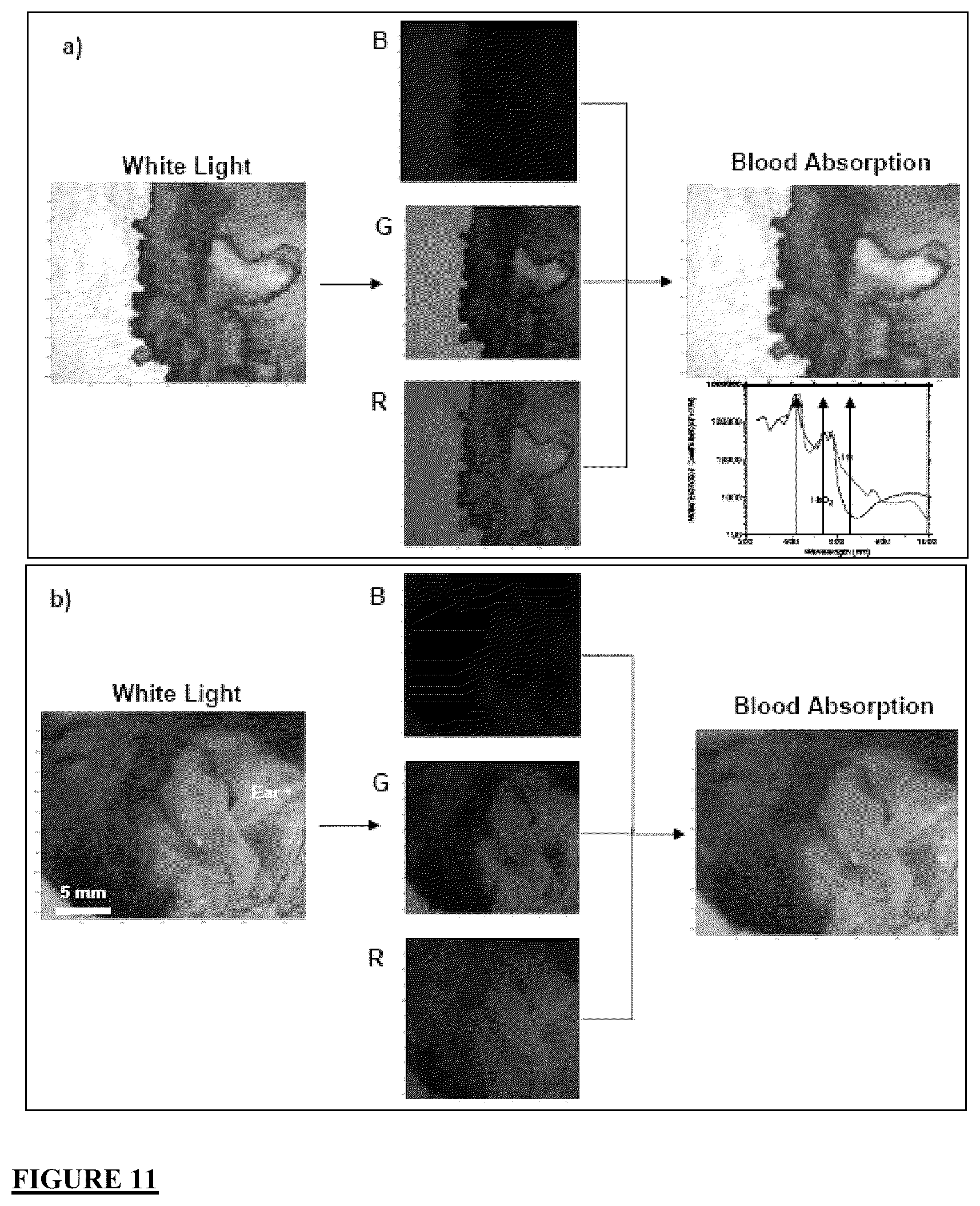 Patent US12616372 Figure 14 – Devices, methods, and systems for fluorescence-based imaging and detection of location(s) and/or source(s) of potential contamination and/or pollution