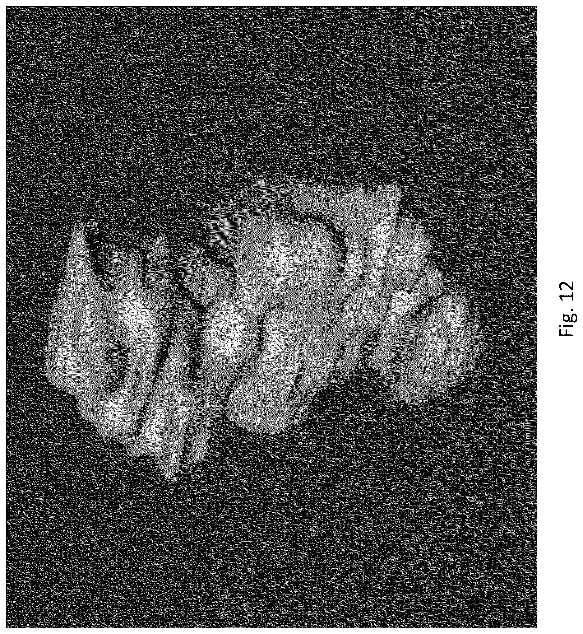 Patent US12616373 Figure 13 – Optical spectroscopy and treatment planning software for photodynamic therapy of hollow cavities