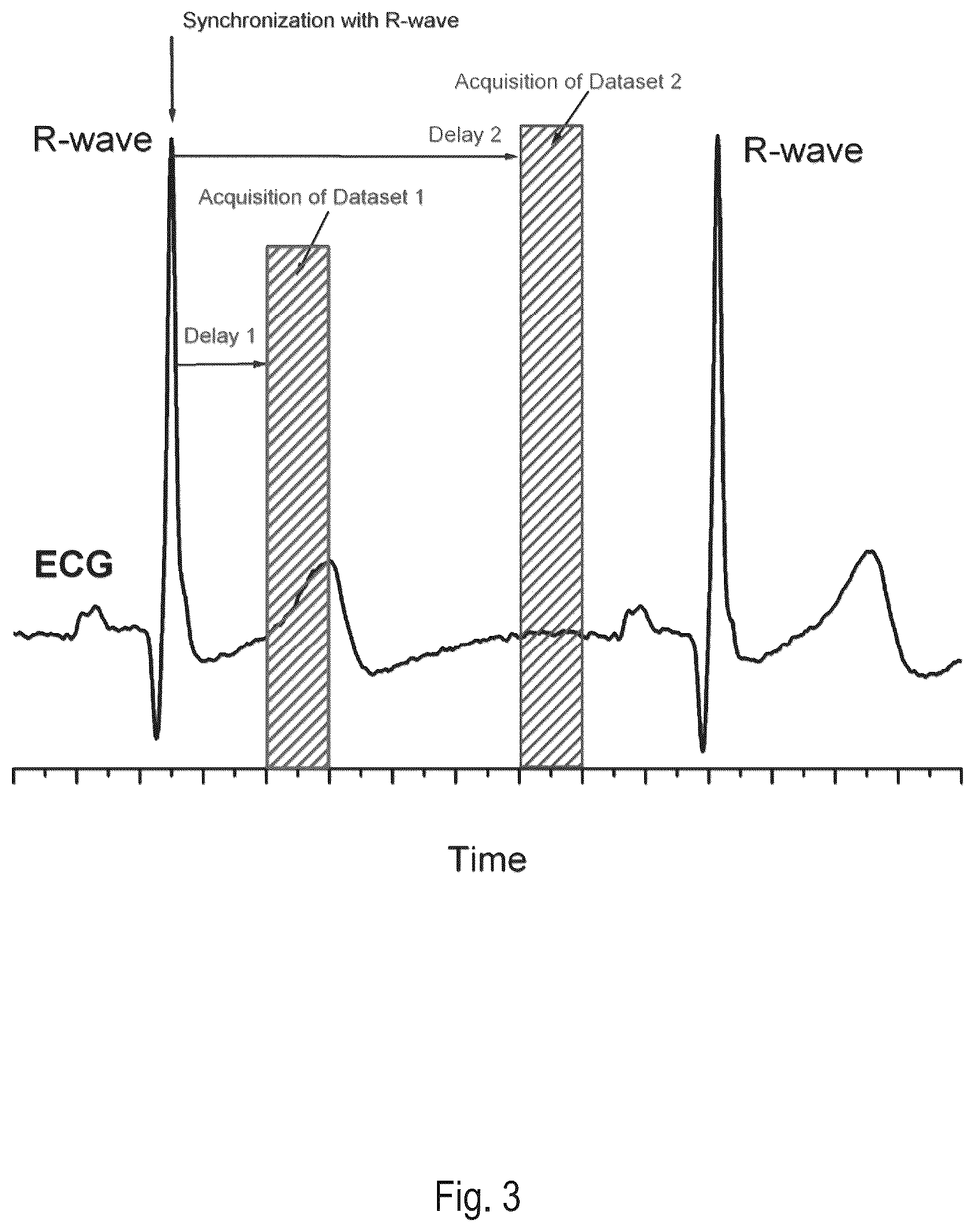 Patent US12616380 Figure 5 – Electromagnetic tomography and tomographic angiography