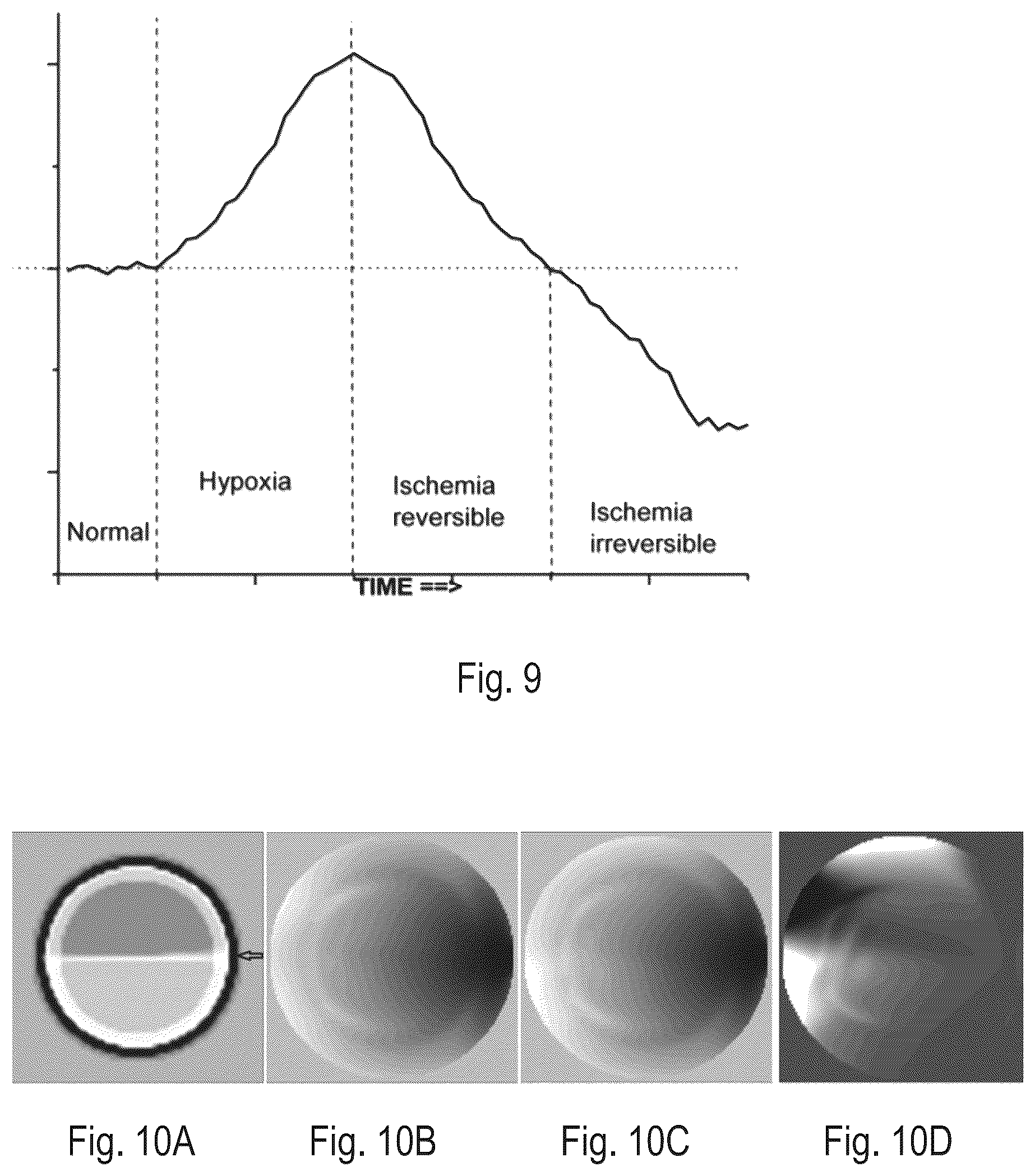 Patent US12616380 Figure 12 – Electromagnetic tomography and tomographic angiography