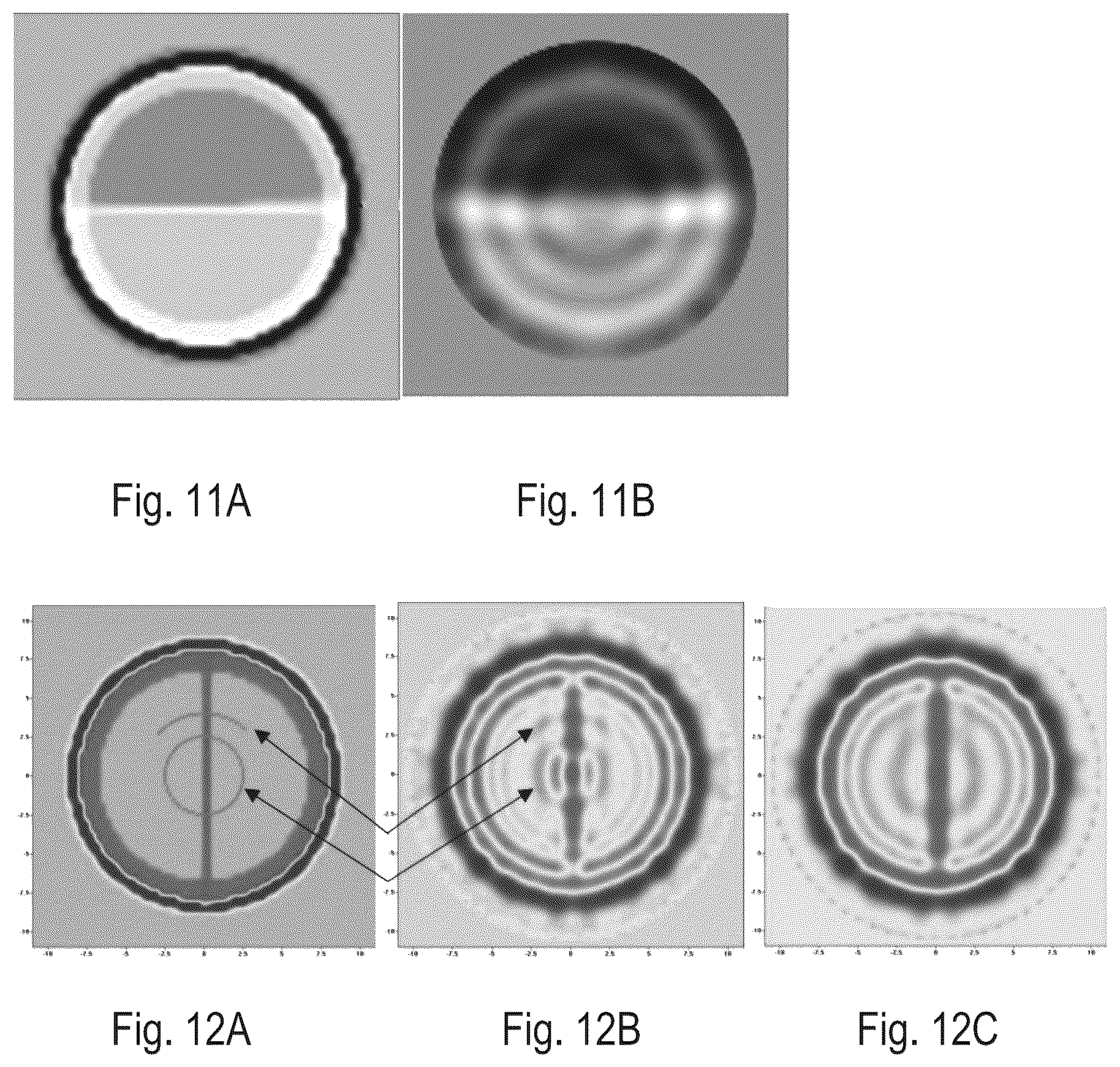 Patent US12616380 Figure 13 – Electromagnetic tomography and tomographic angiography