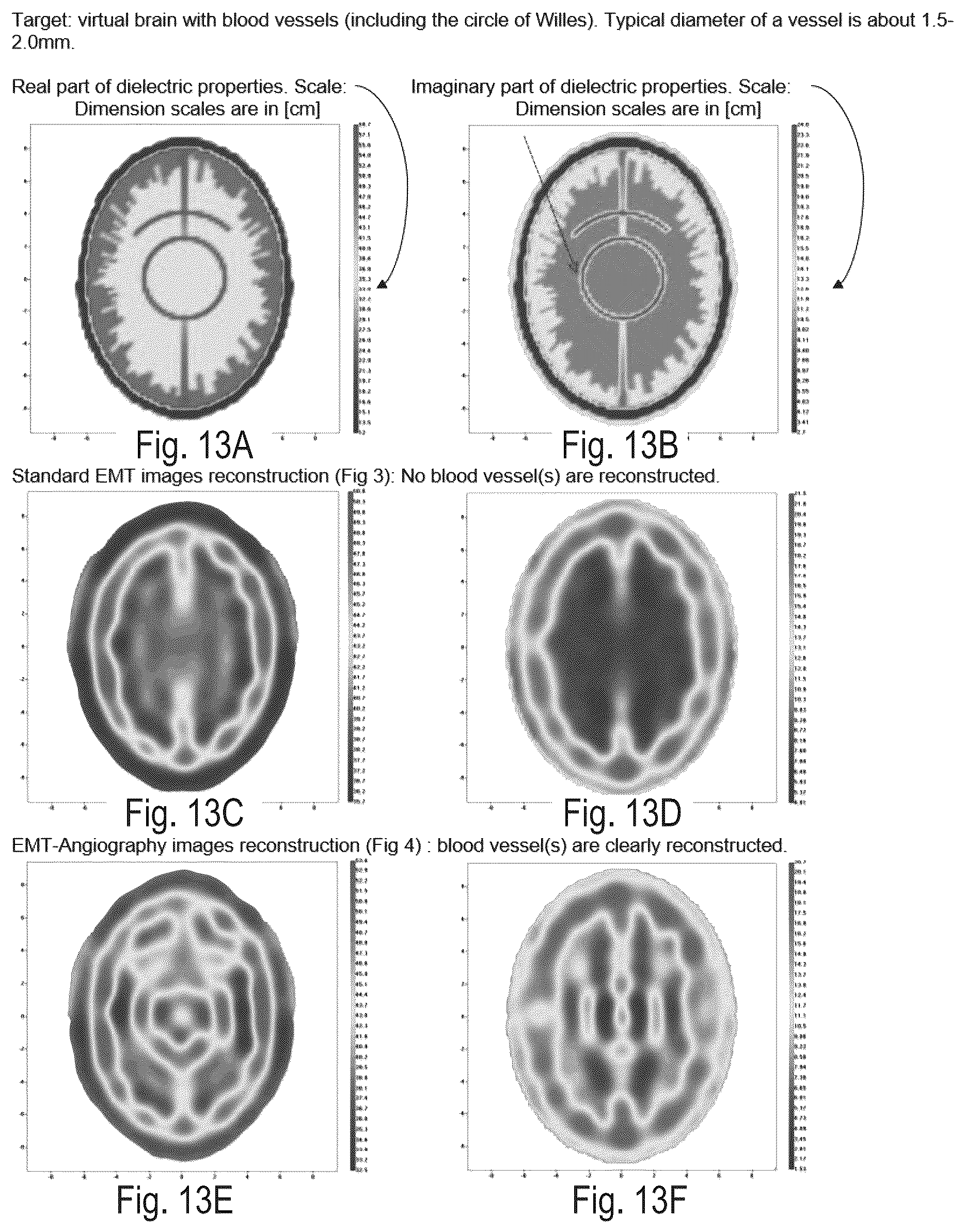 Patent US12616380 Figure 14 – Electromagnetic tomography and tomographic angiography