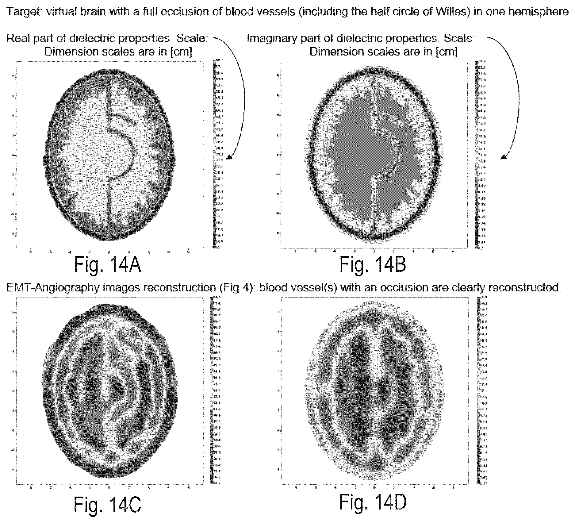 Patent US12616380 Figure 15 – Electromagnetic tomography and tomographic angiography