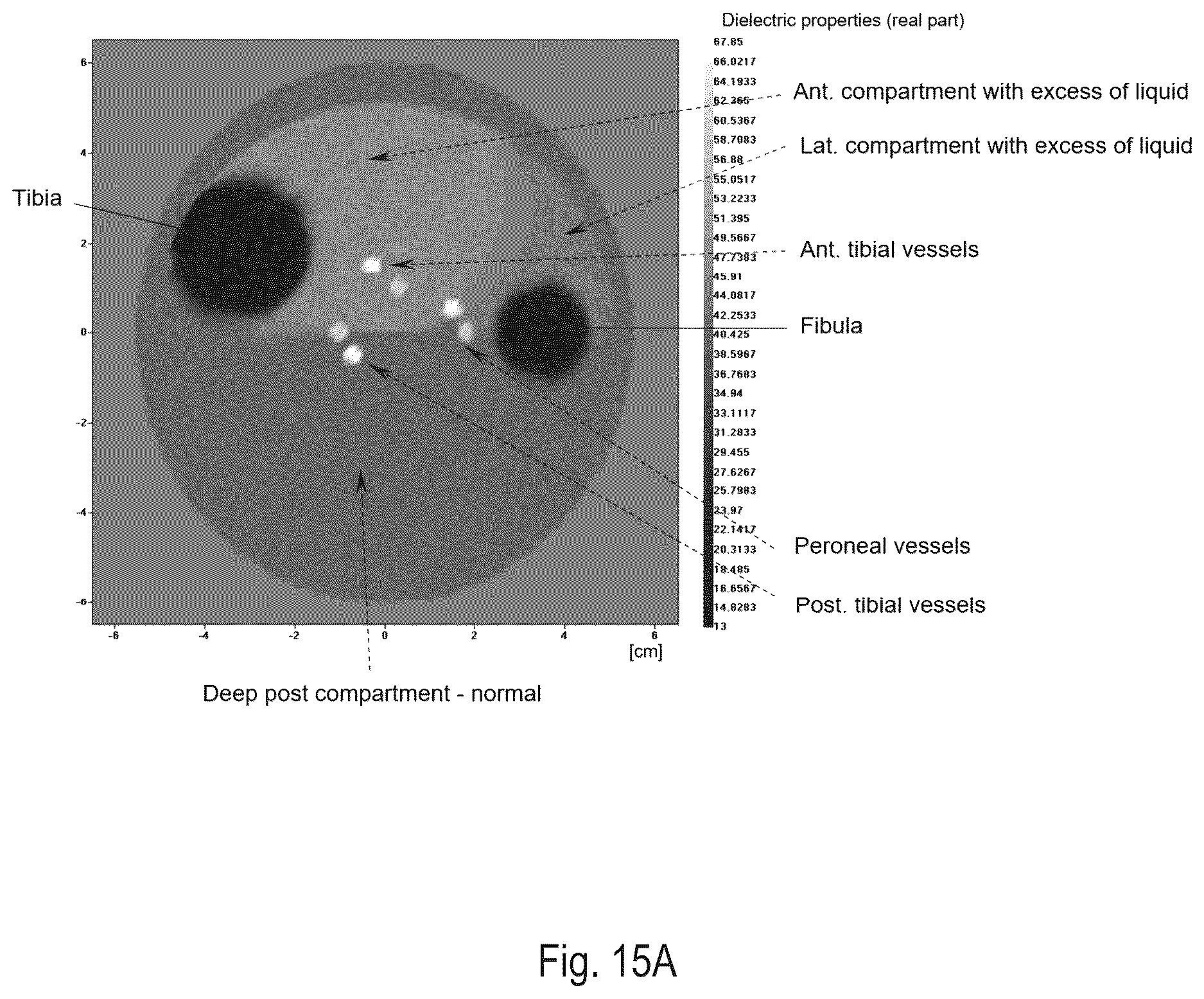 Patent US12616380 Figure 16 – Electromagnetic tomography and tomographic angiography