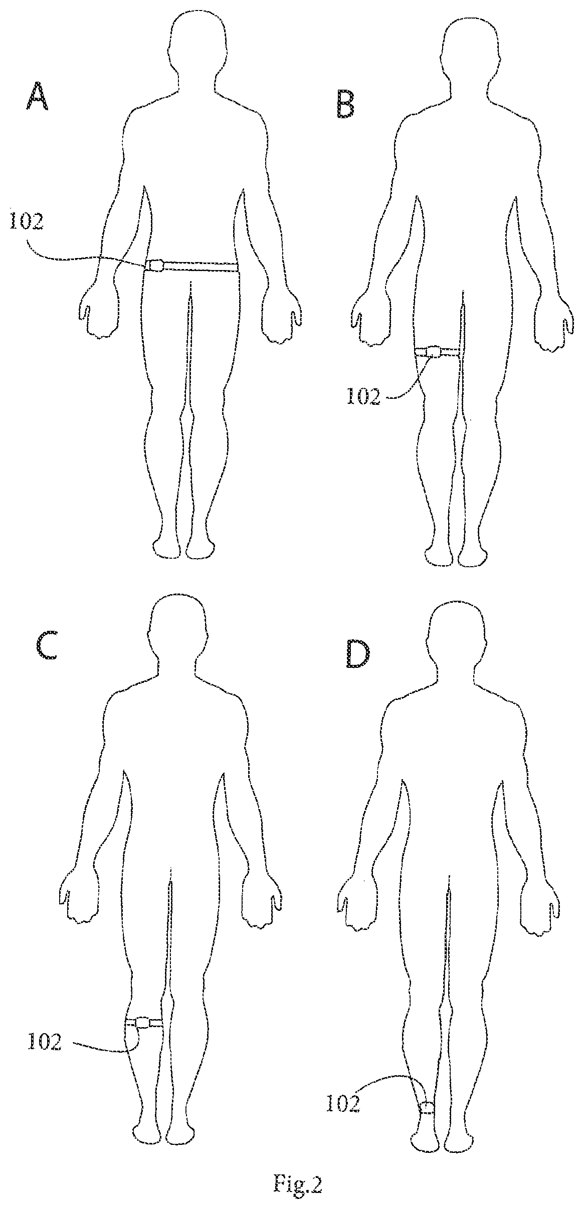 Patent US12616381 Figure 2 – System for management and prevention of venous pooling