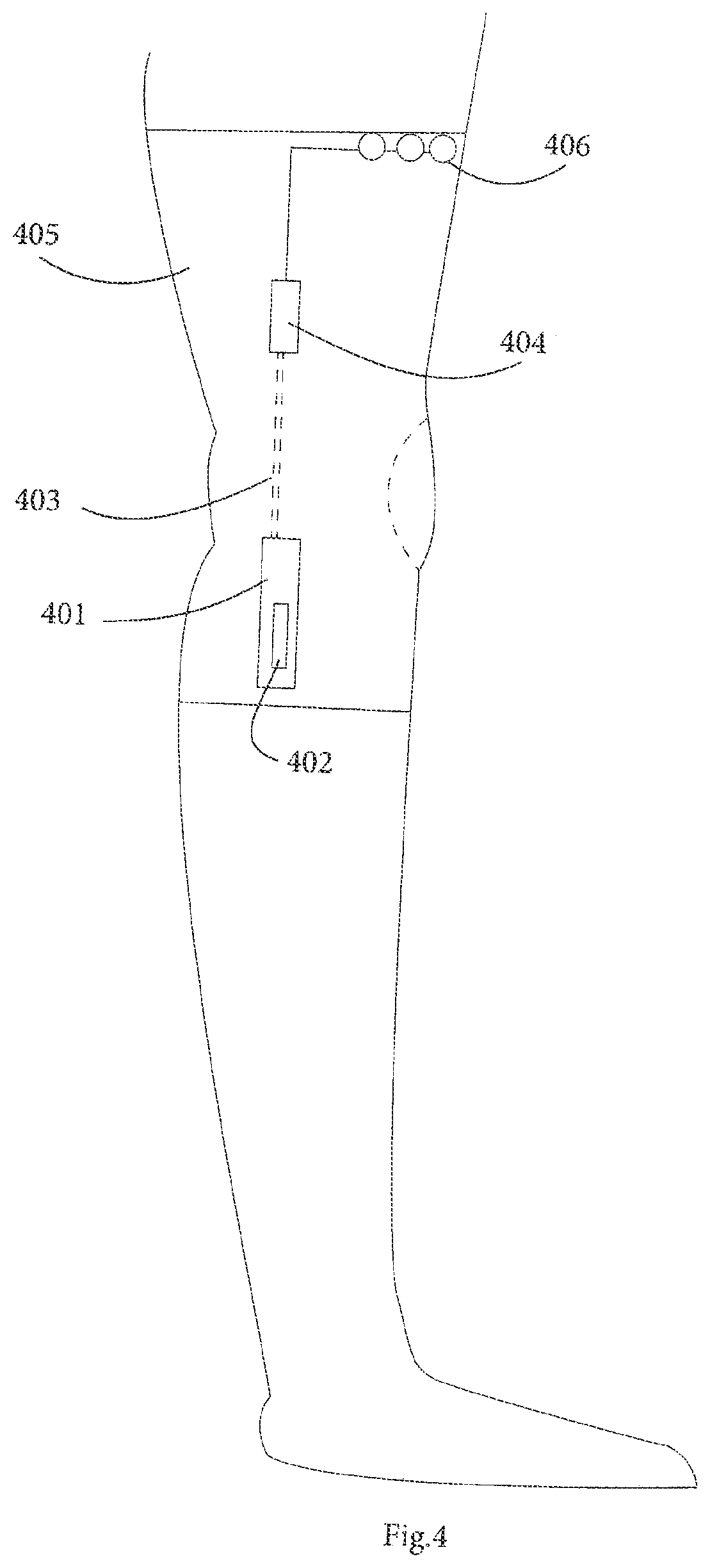 Patent US12616381 Figure 4 – System for management and prevention of venous pooling