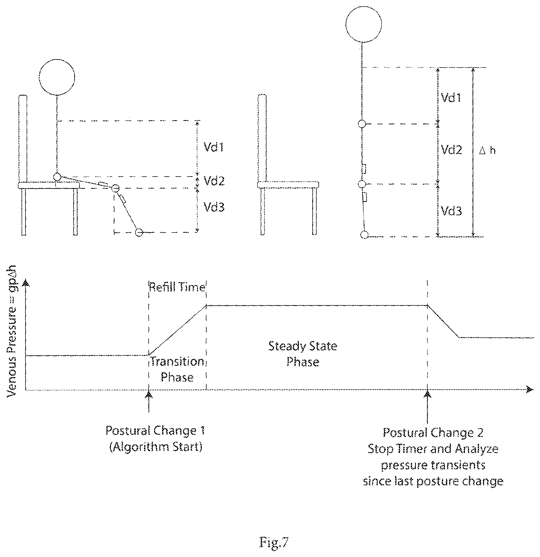Patent US12616381 Figure 7 – System for management and prevention of venous pooling