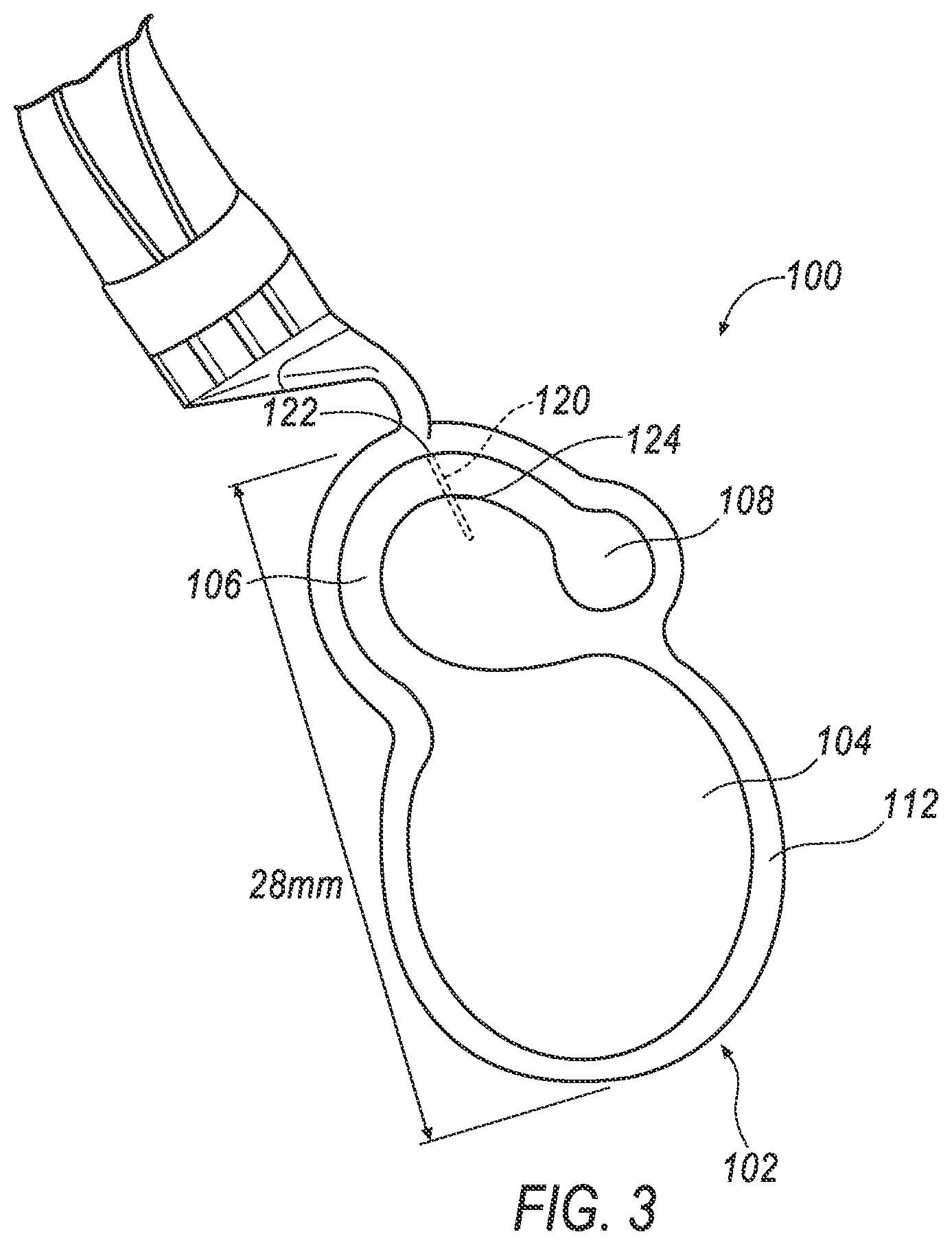 Patent US12616382 Figure 3 – Wearable mechano-acoustic sensor