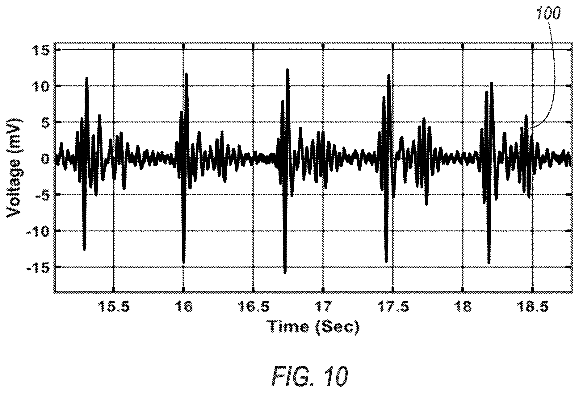 Patent US12616382 Figure 10 – Wearable mechano-acoustic sensor