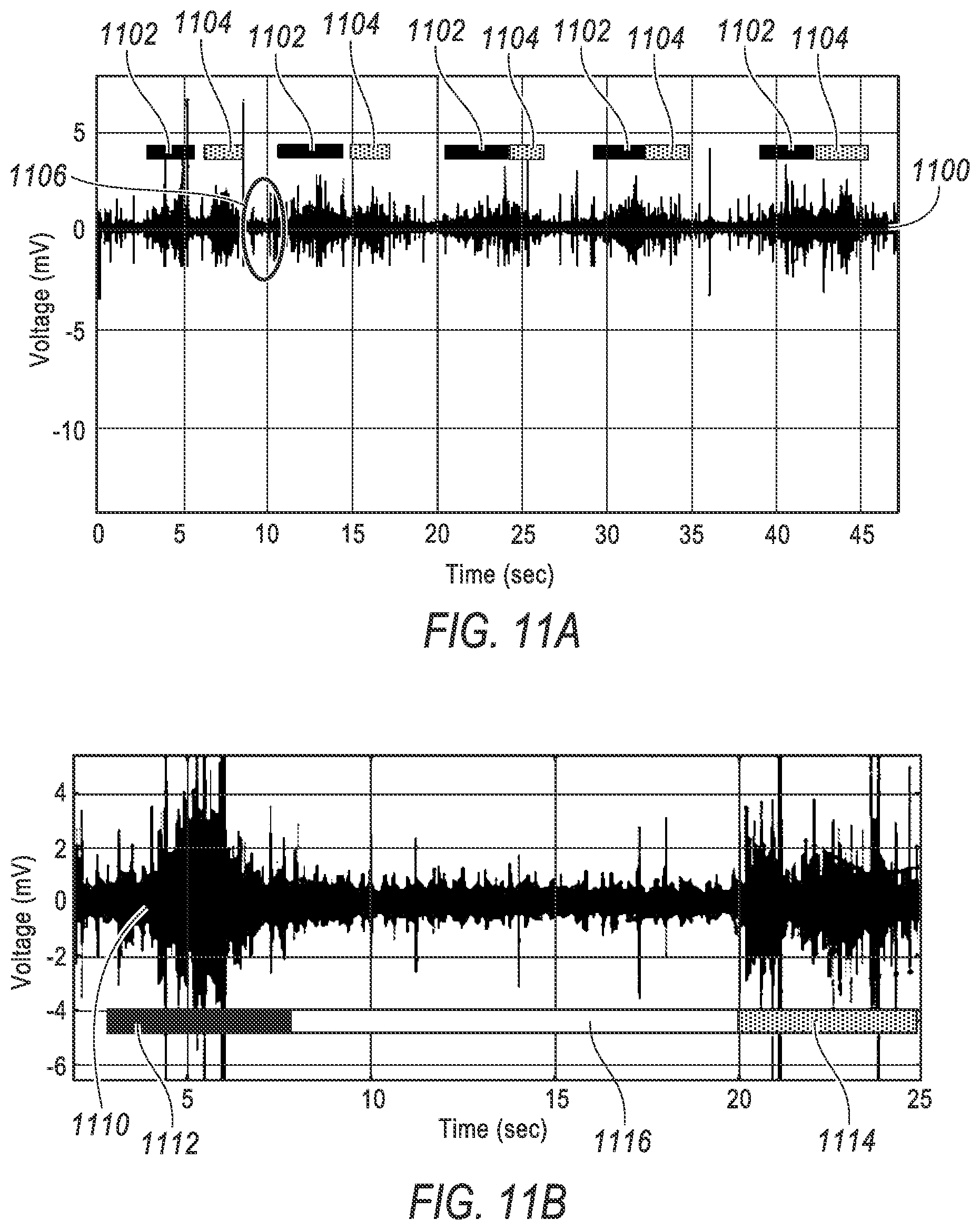 Patent US12616382 Figure 11 – Wearable mechano-acoustic sensor