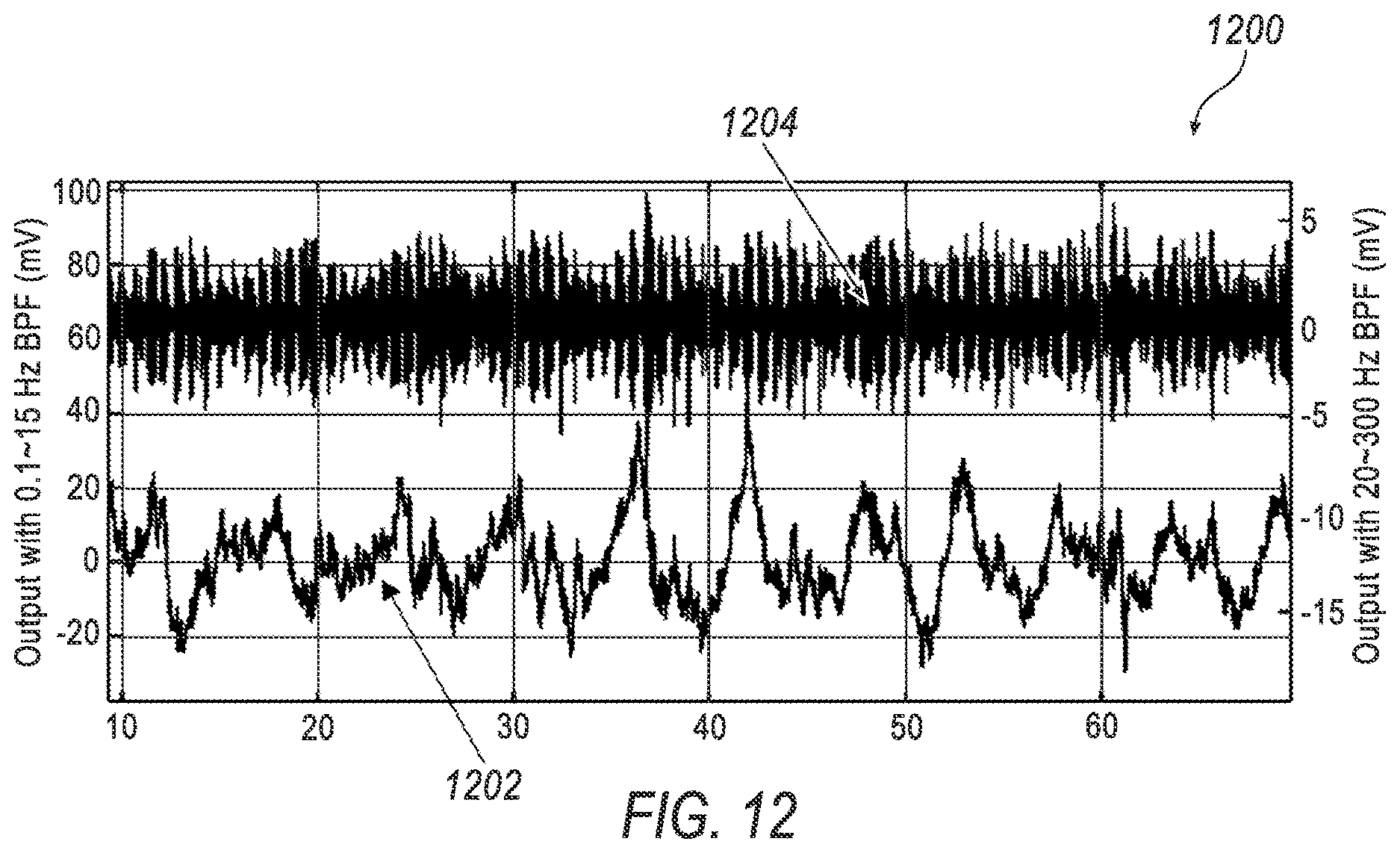 Patent US12616382 Figure 12 – Wearable mechano-acoustic sensor