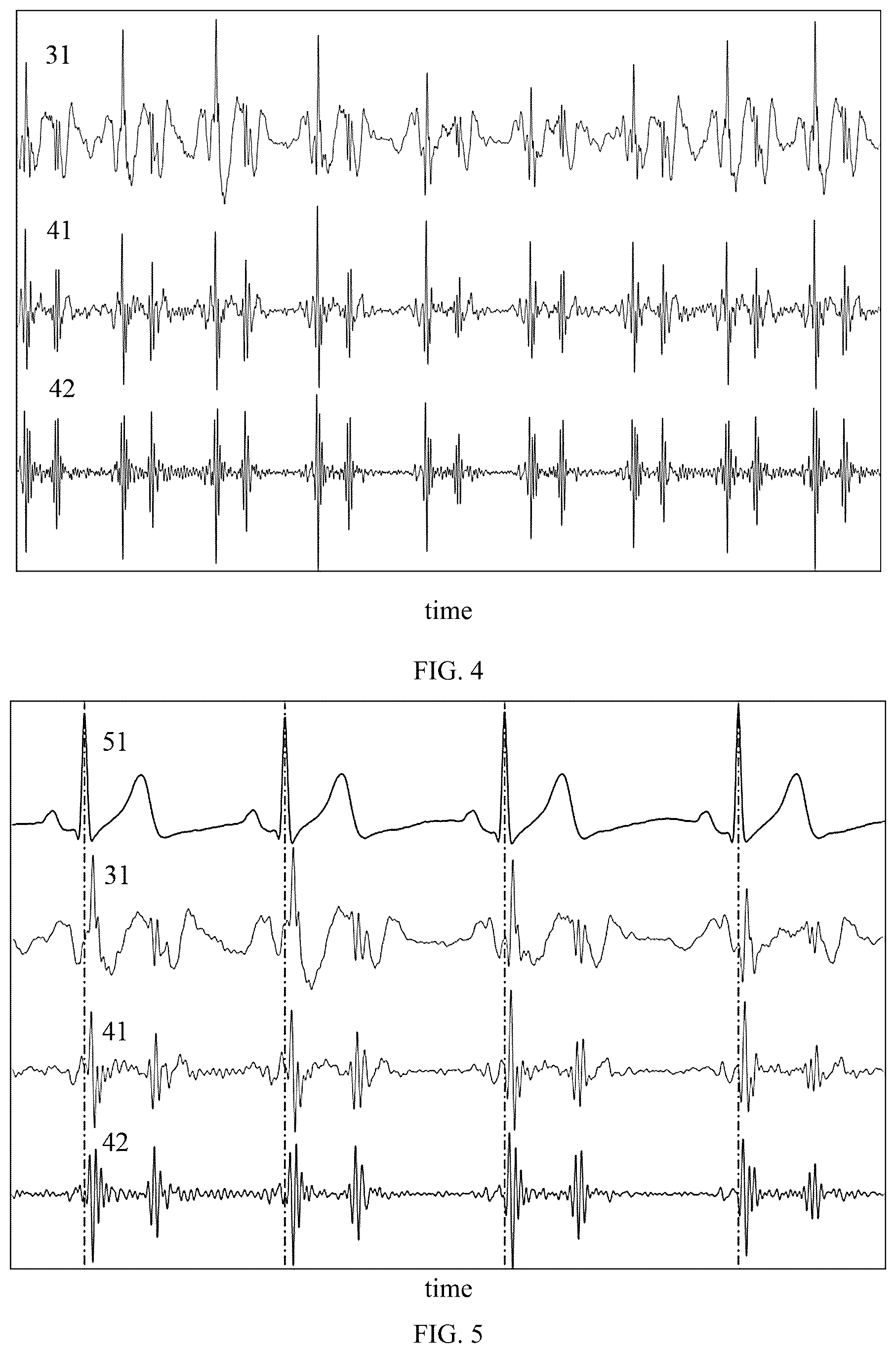 Patent US12616384 Figure 3 – Cardiac diastolic function assessment method, device and system