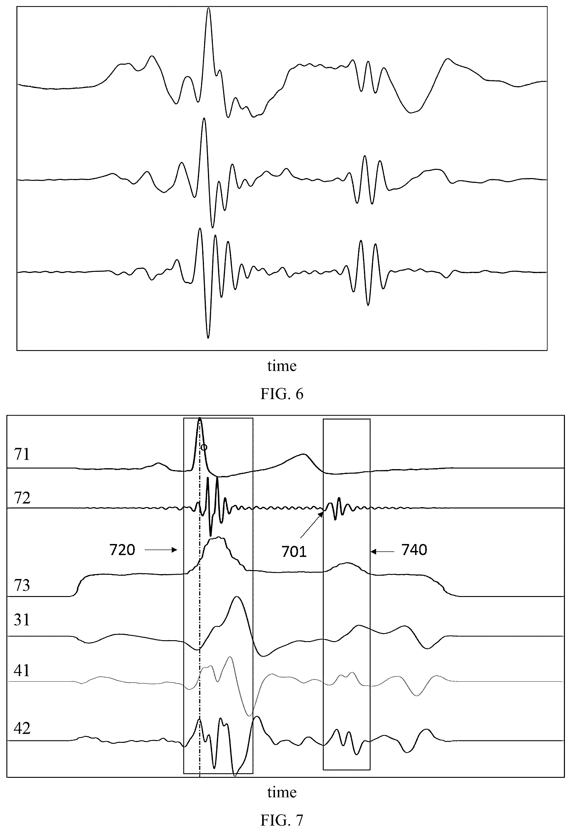 Patent US12616384 Figure 4 – Cardiac diastolic function assessment method, device and system