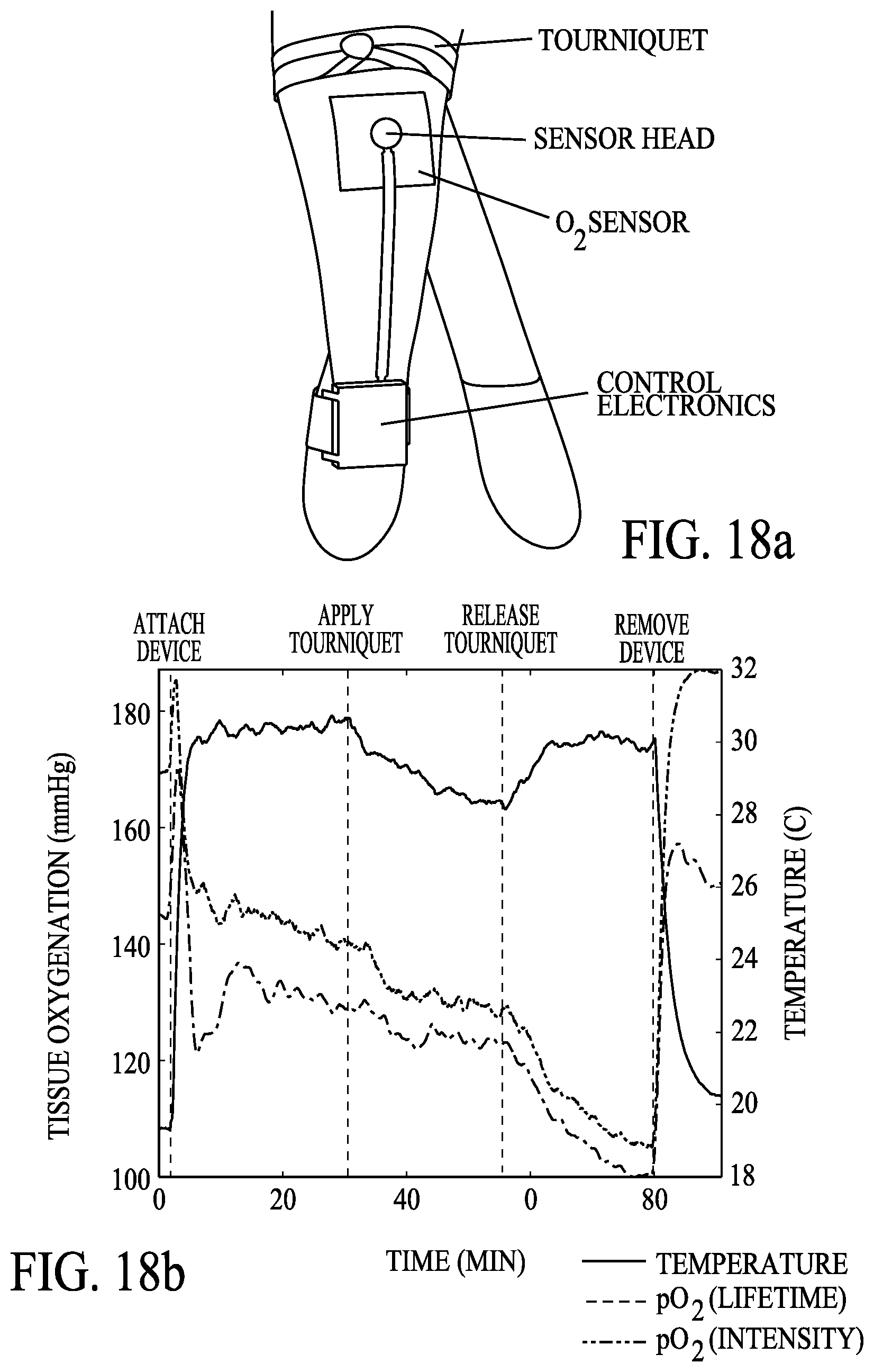 Patent US12616398 Figure 19 – Systems and methods for monitoring an analyte or parameter for a patient