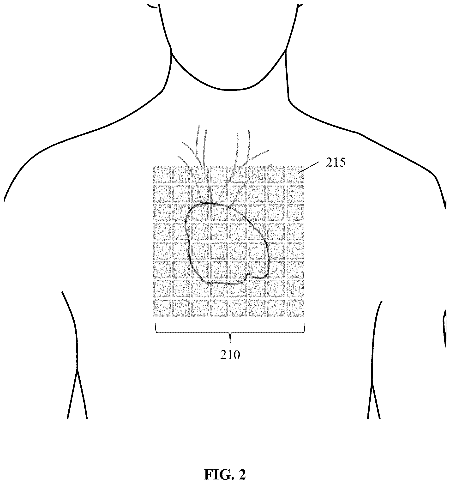 Patent US12616402 Figure 2 – Unshielded pulsed pump magnetometers for biomagnetic measurements