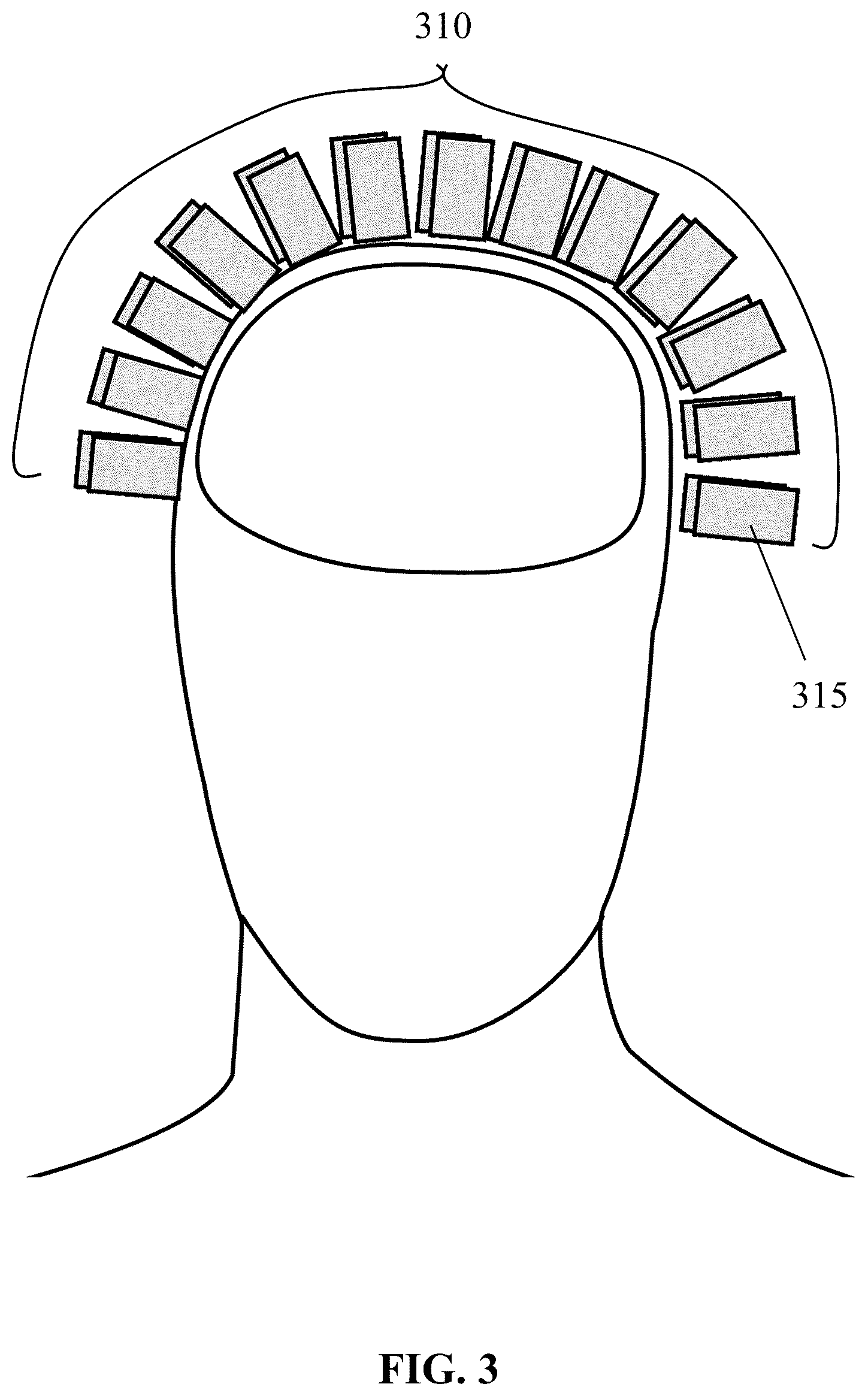 Patent US12616402 Figure 3 – Unshielded pulsed pump magnetometers for biomagnetic measurements