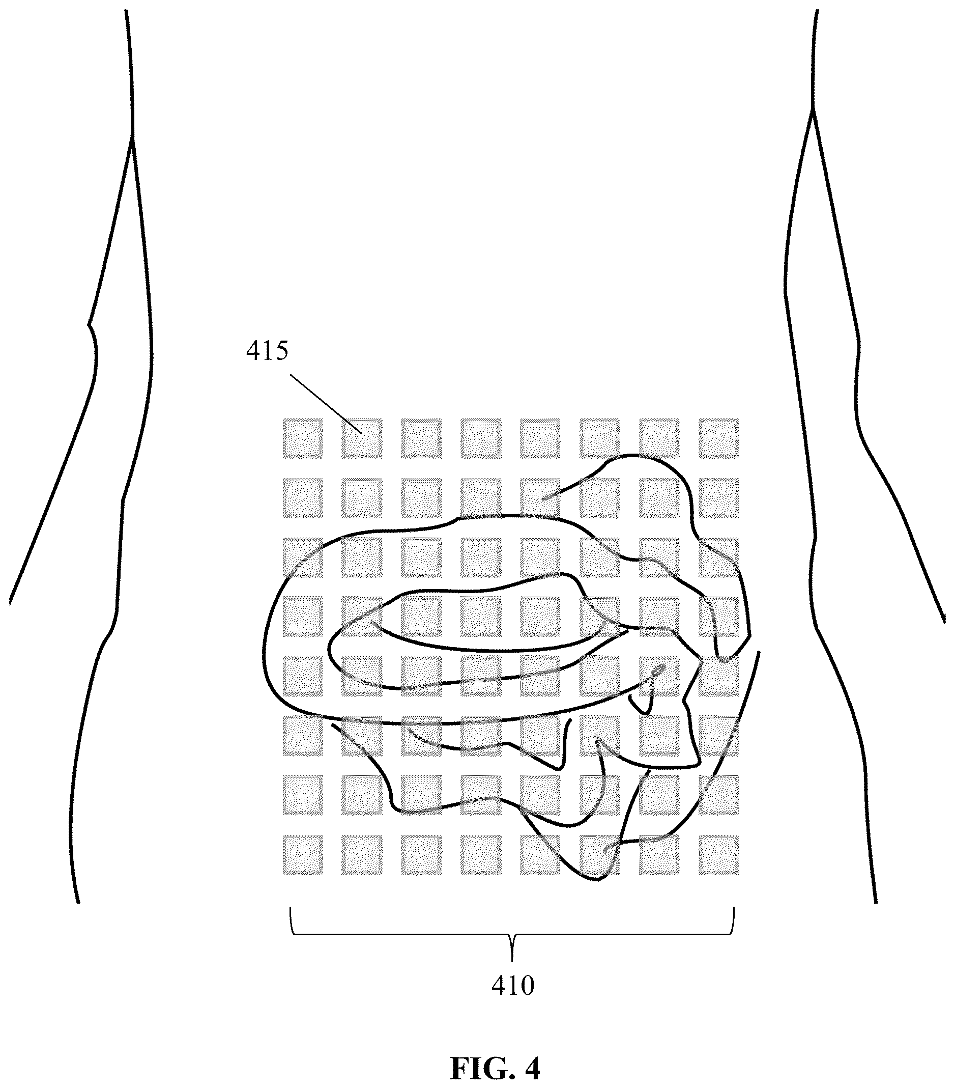 Patent US12616402 Figure 4 – Unshielded pulsed pump magnetometers for biomagnetic measurements