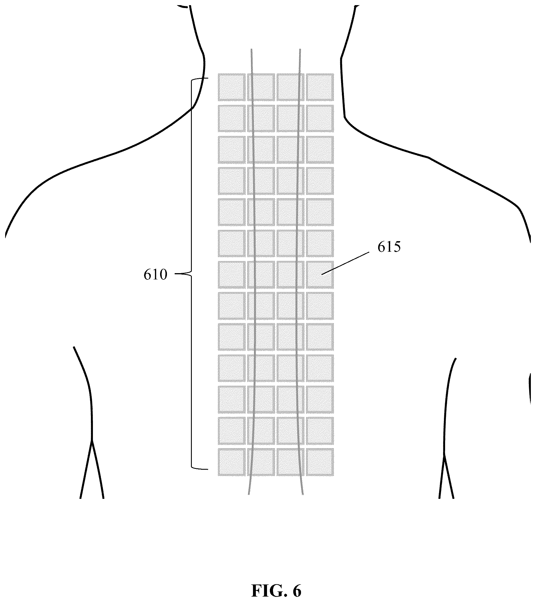 Patent US12616402 Figure 6 – Unshielded pulsed pump magnetometers for biomagnetic measurements