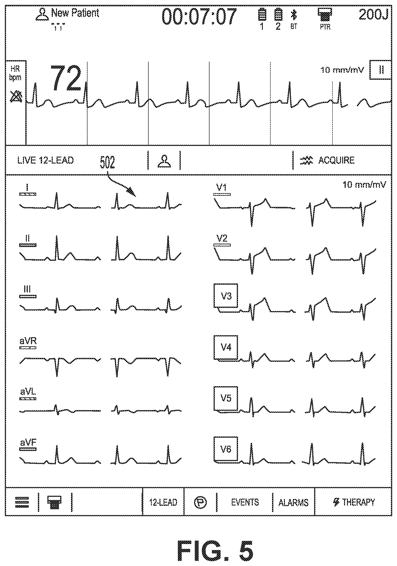 Patent US12616405 Figure 5 – Providing a live-lead view