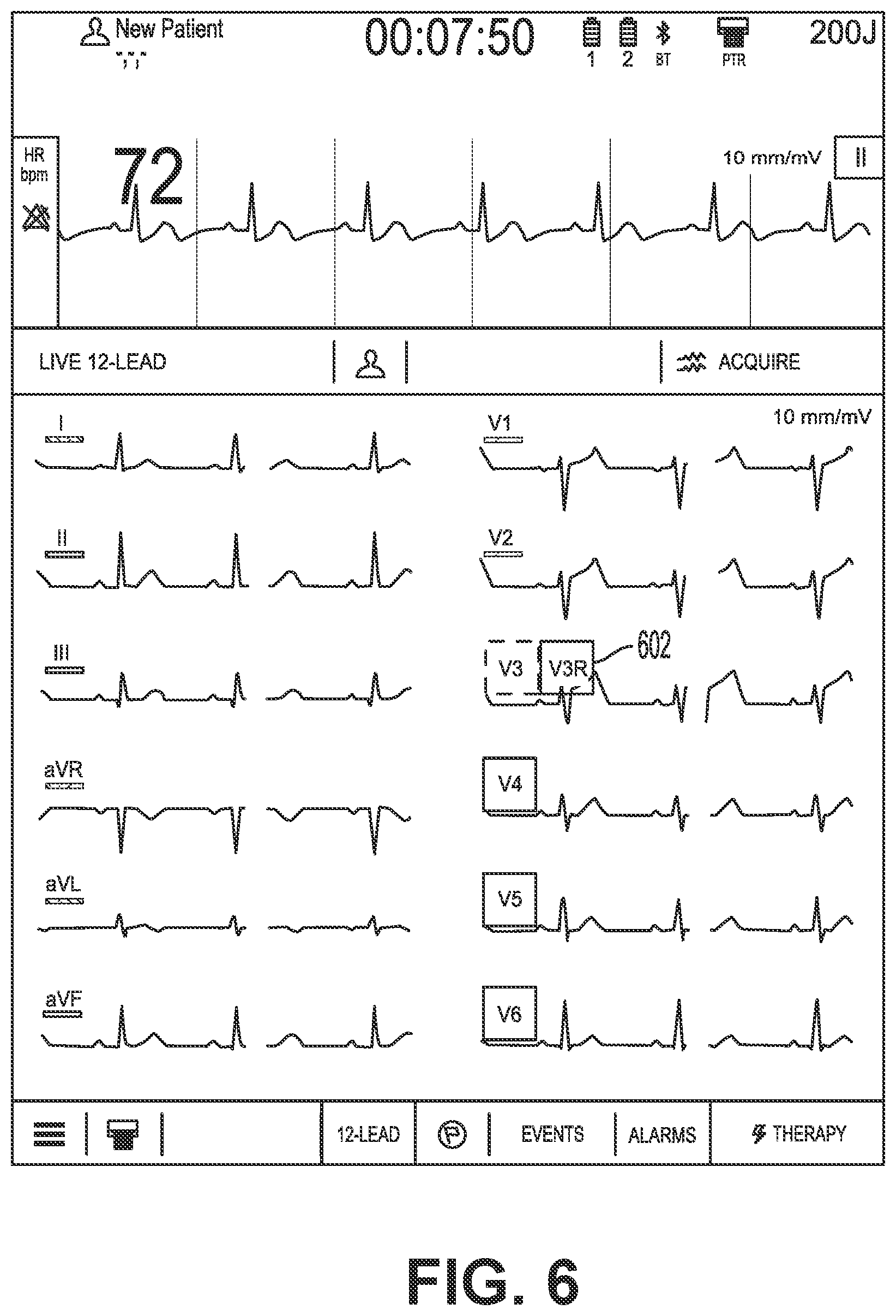 Patent US12616405 Figure 6 – Providing a live-lead view