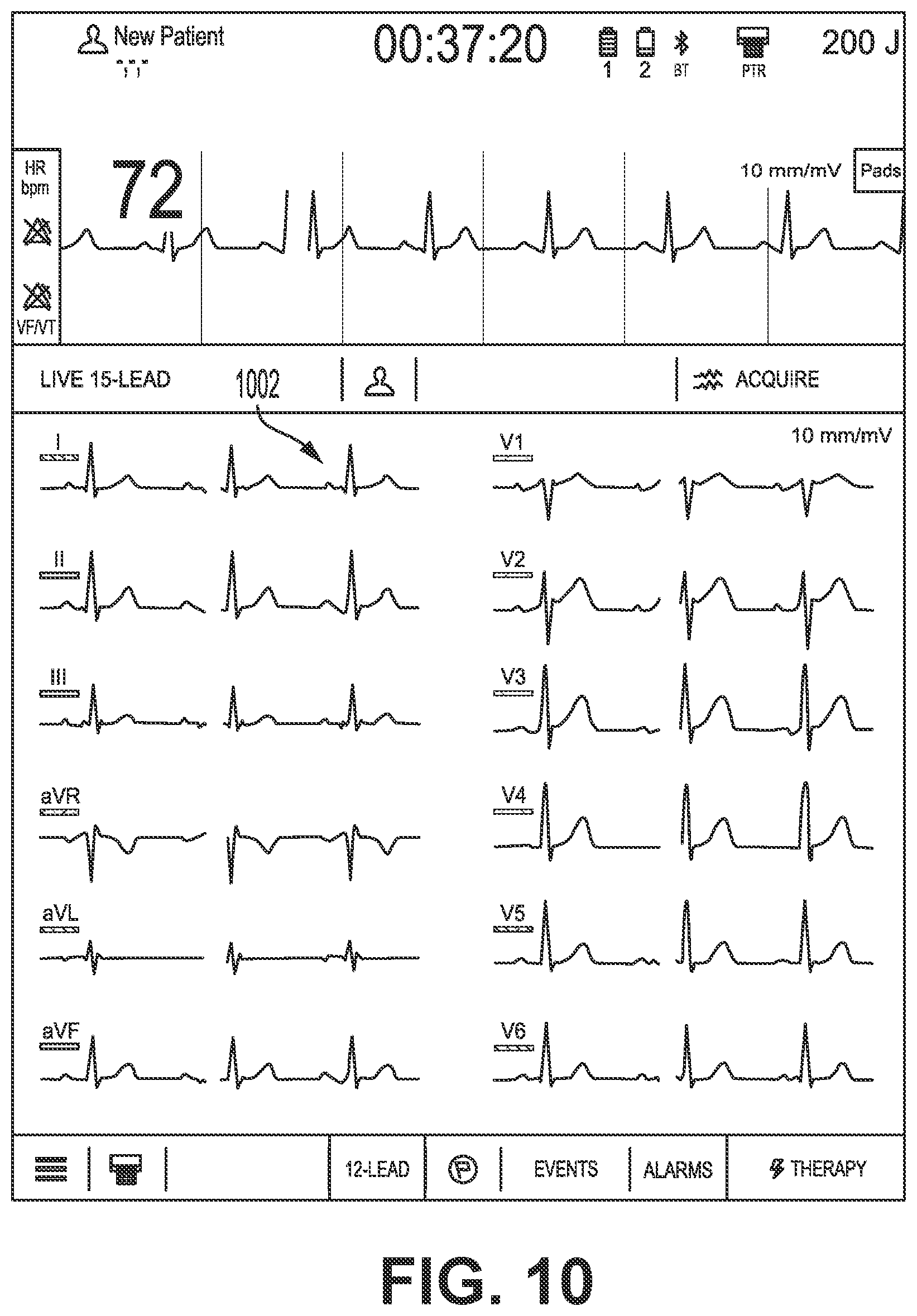 Patent US12616405 Figure 10 – Providing a live-lead view